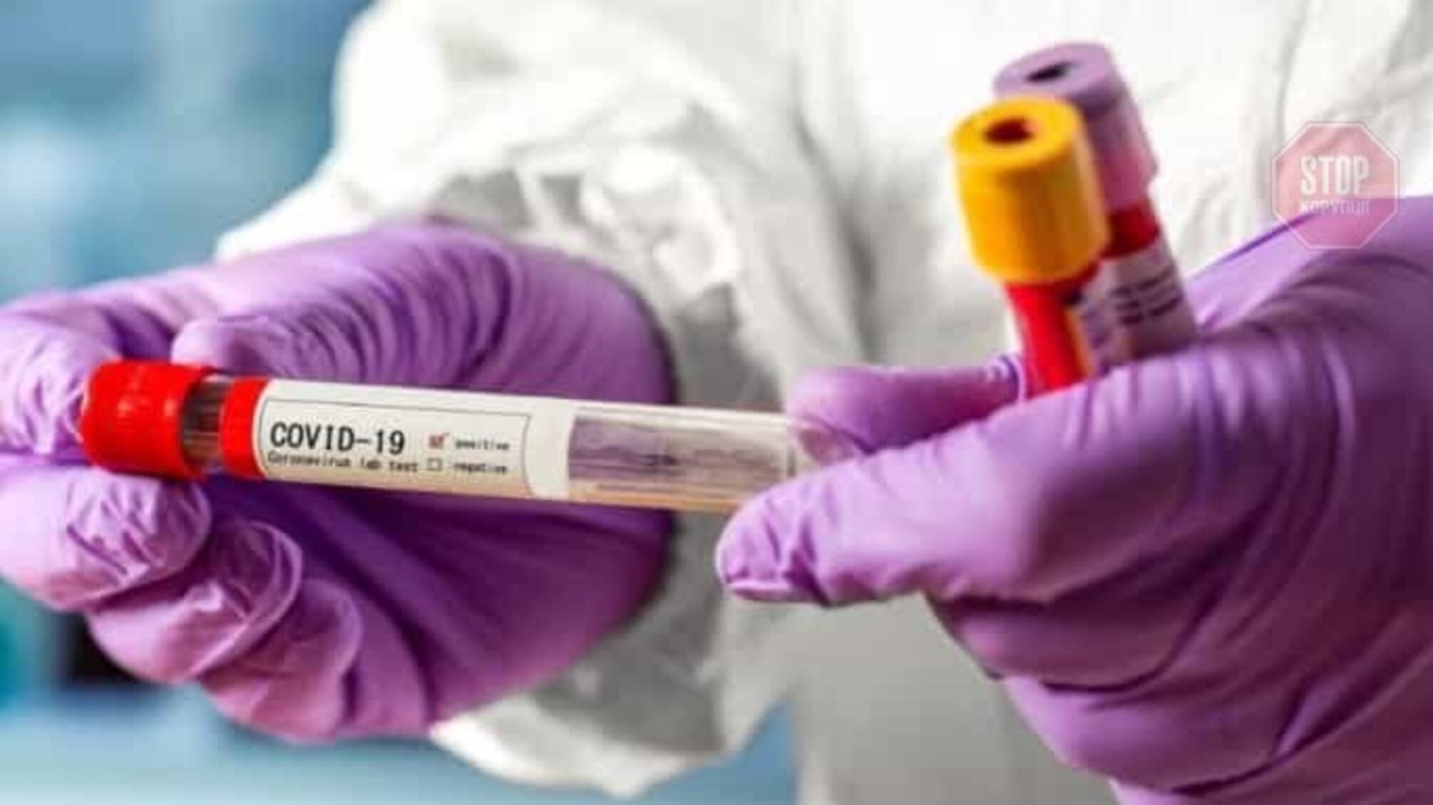 У Тернопільській області зареєстрували два спалахи коронавірусу