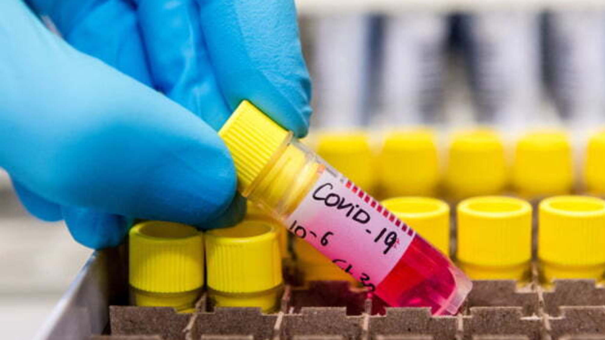 У Нідерландах нарахували вже понад сім тисяч випадків COVID-19 за добу
