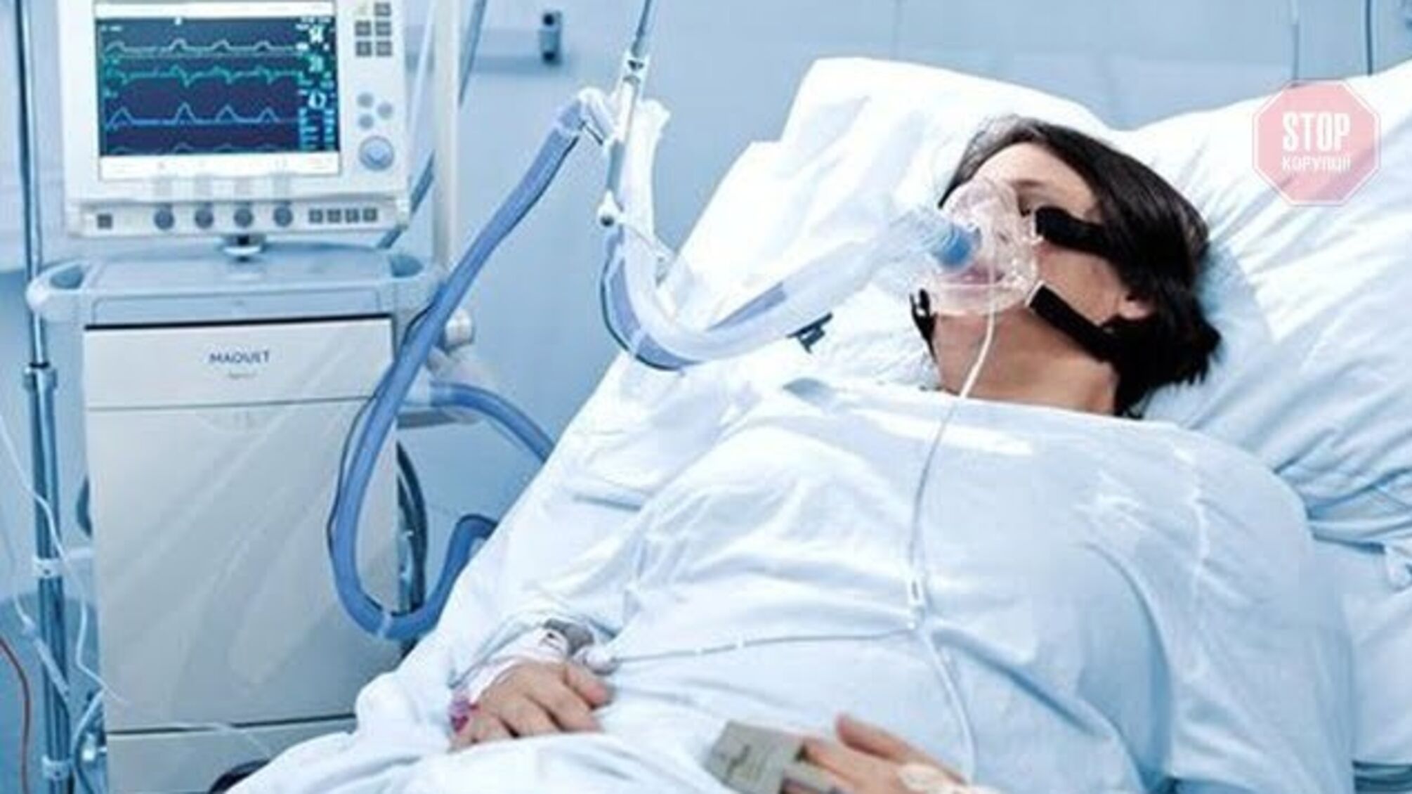 МОЗ вперше закупить апарати ШВЛ за гроші із коронавірусного фонду