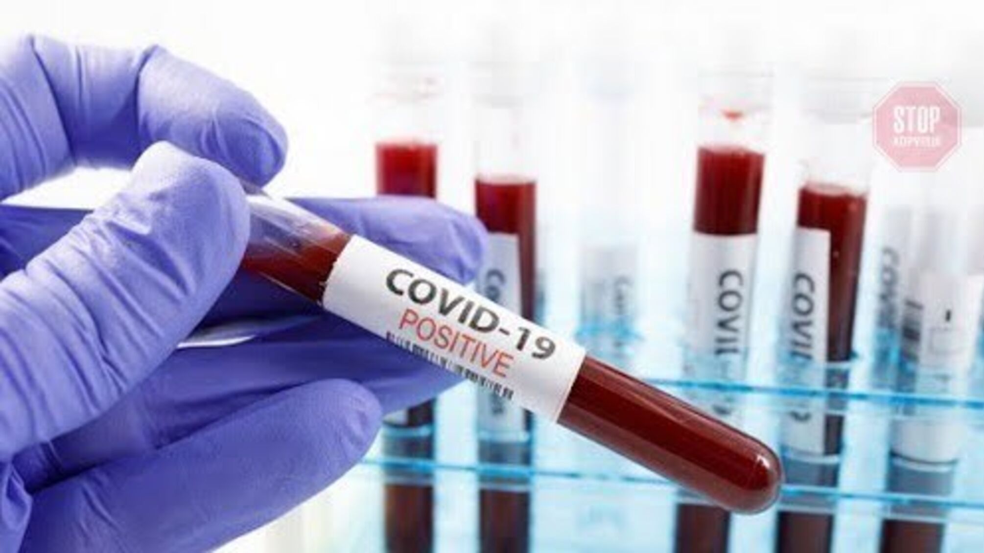 У Києві за минулу добу зафіксували понад 400 випадків коронавірусу