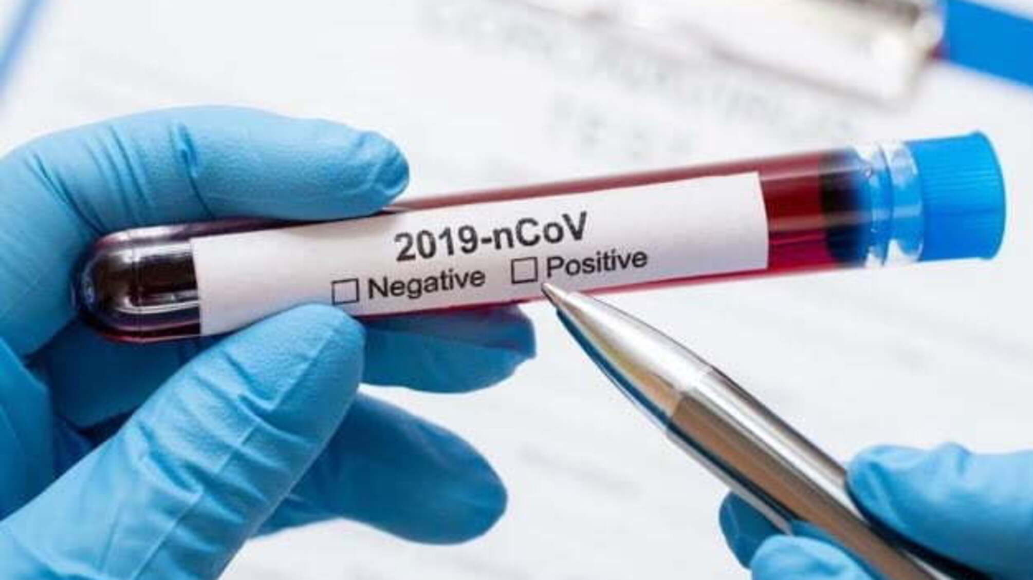 Пандемія COVID-19 страшніша за ядерну війну - військовий експерт