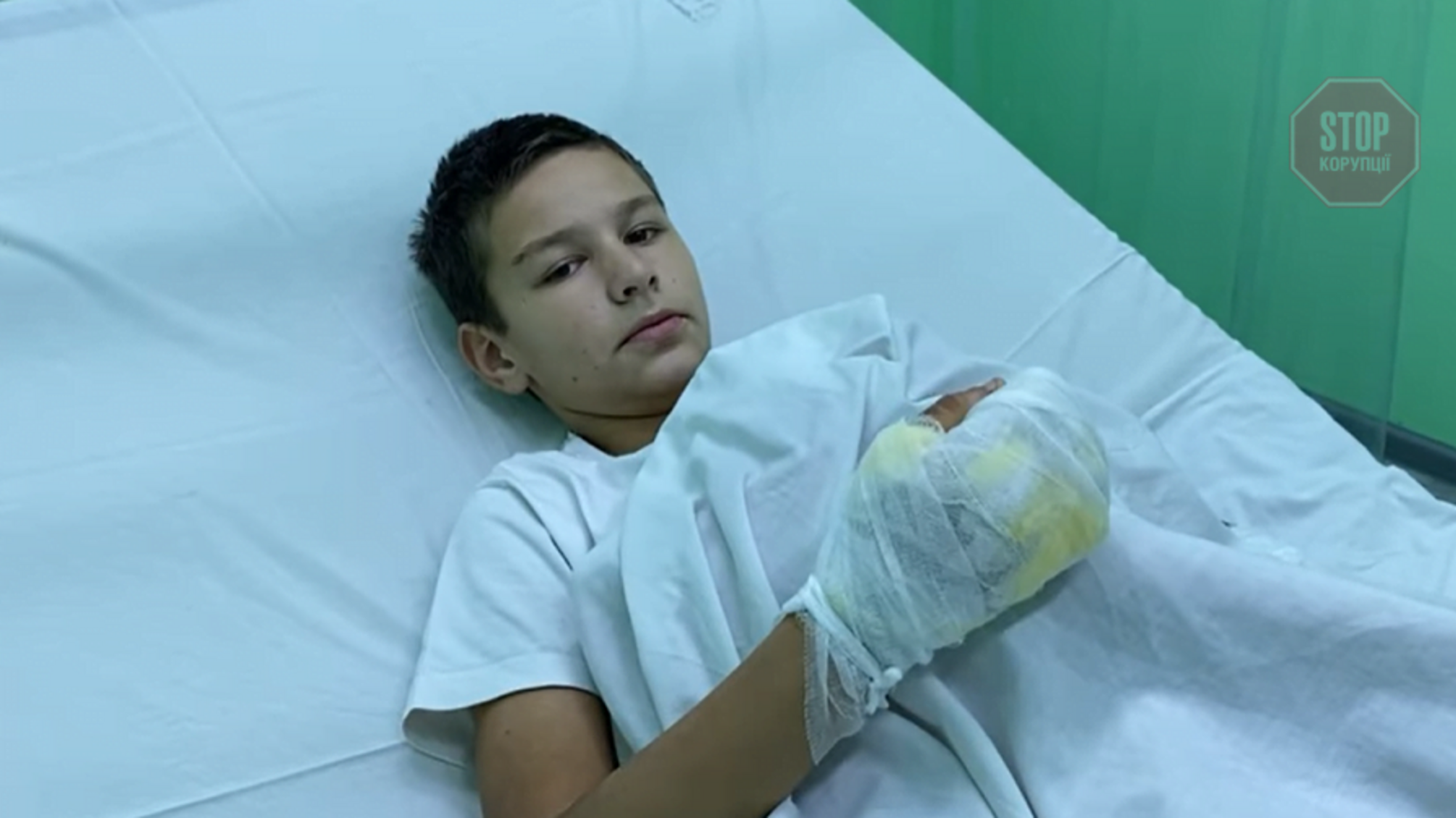 Підпал 12-річної дитини у Бердянську: хлопець розповів про погрози зі сторони друзів (відео)