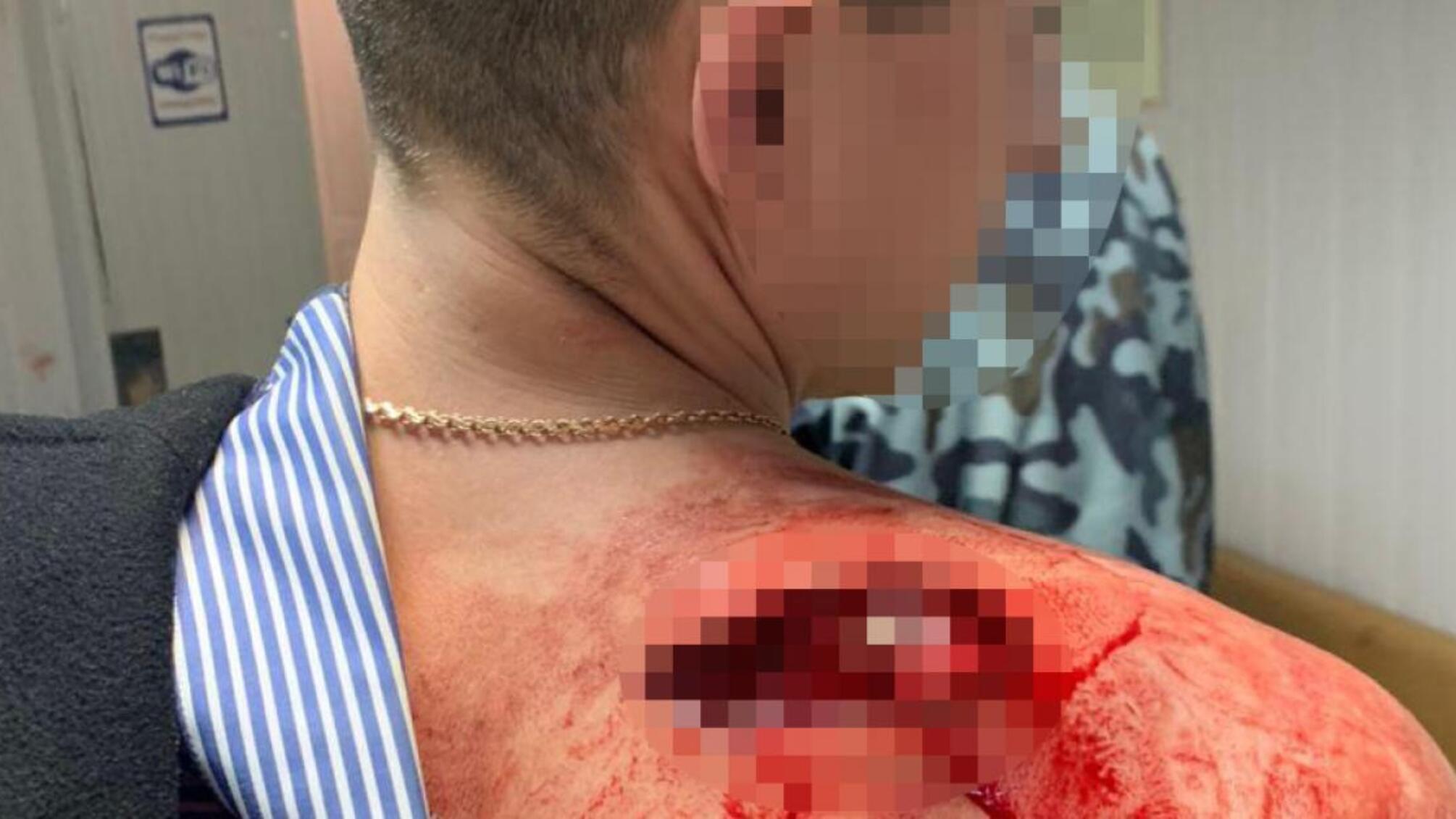 З’ясування стосунків з використанням вогнепальної зброї — ДБР повідомило про підозру патрульному поліцейському (ВІДЕО)