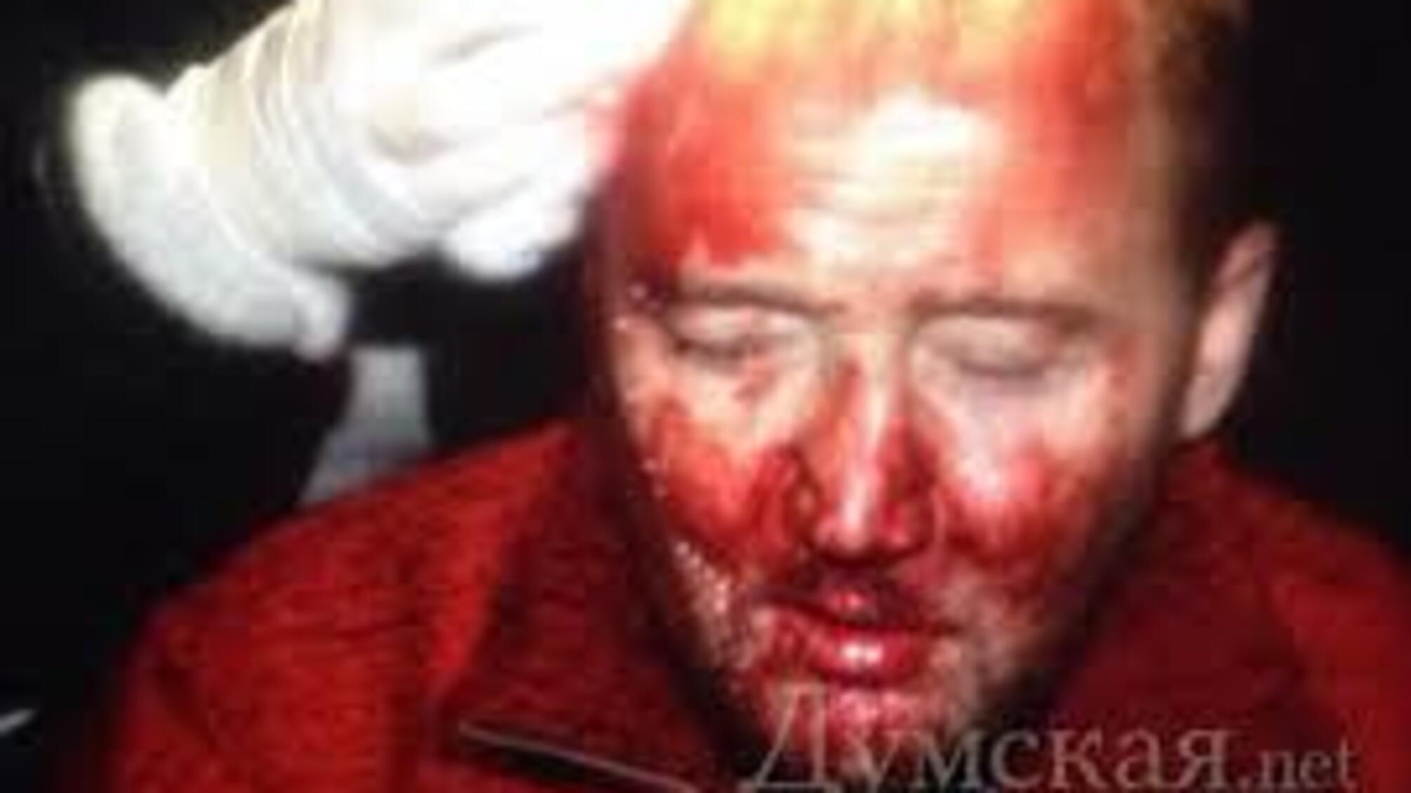 Журналистов в Киеве массово избивала милиция, а добивали провокаторы