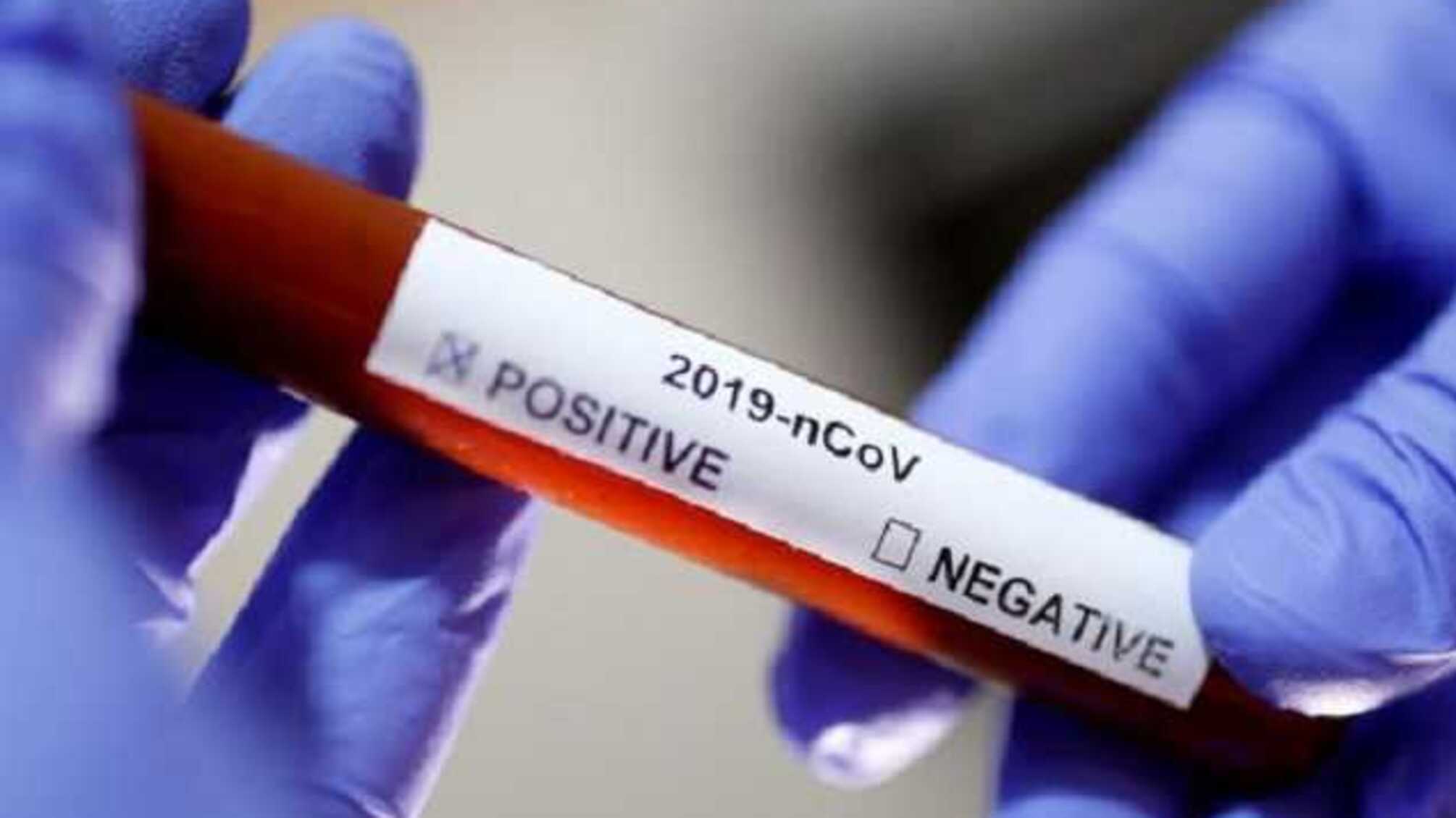 В Украине объявили о создании собственной тест-системы для определения коронавируса