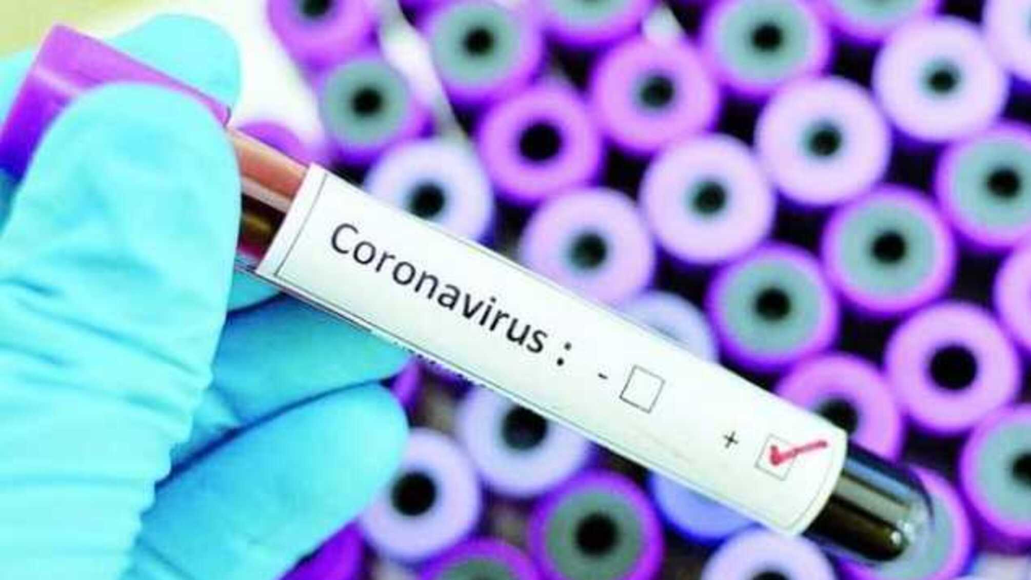 Вакцины против коронавируса нет и в ближайшее время не будет — Институт Роберта Коха