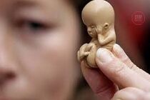 На Херсонщині студентка намагался позбутися немовляти: дівчинка померла