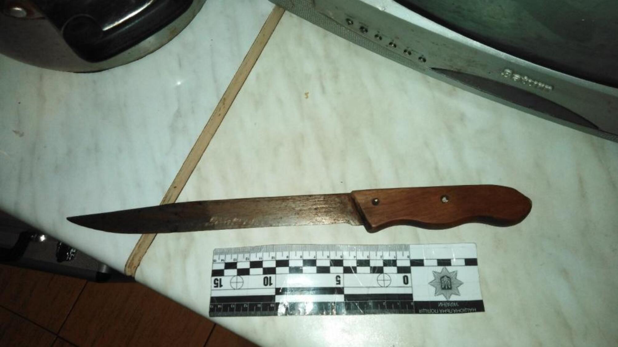 Ізмаїльські правоохоронці оголосили про підозру пенсіонеру, який спричинив тяжкі тілесні ушкодження онукові