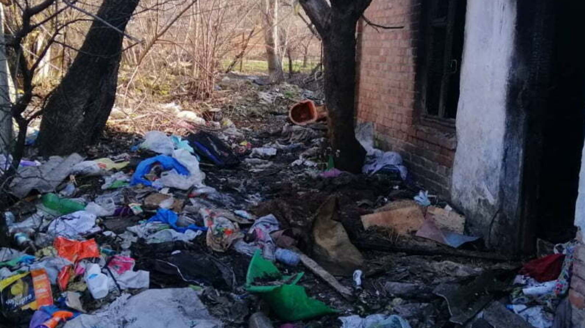 Житомирська область: на пожежі в приватному житловому будинку травмувалася людина