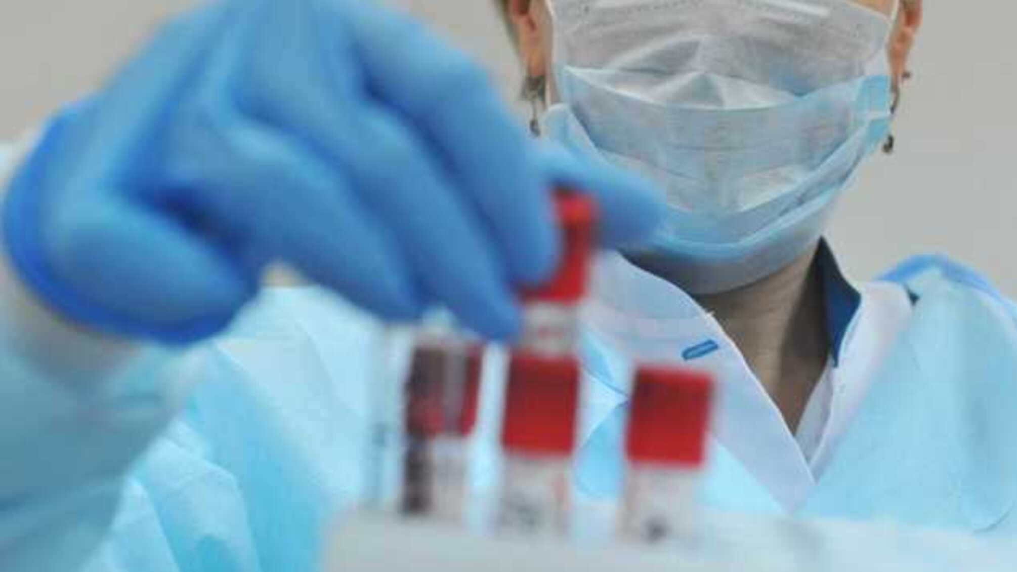 Обнародованы результаты тестов украинцев, у которых подозревали коронавирус