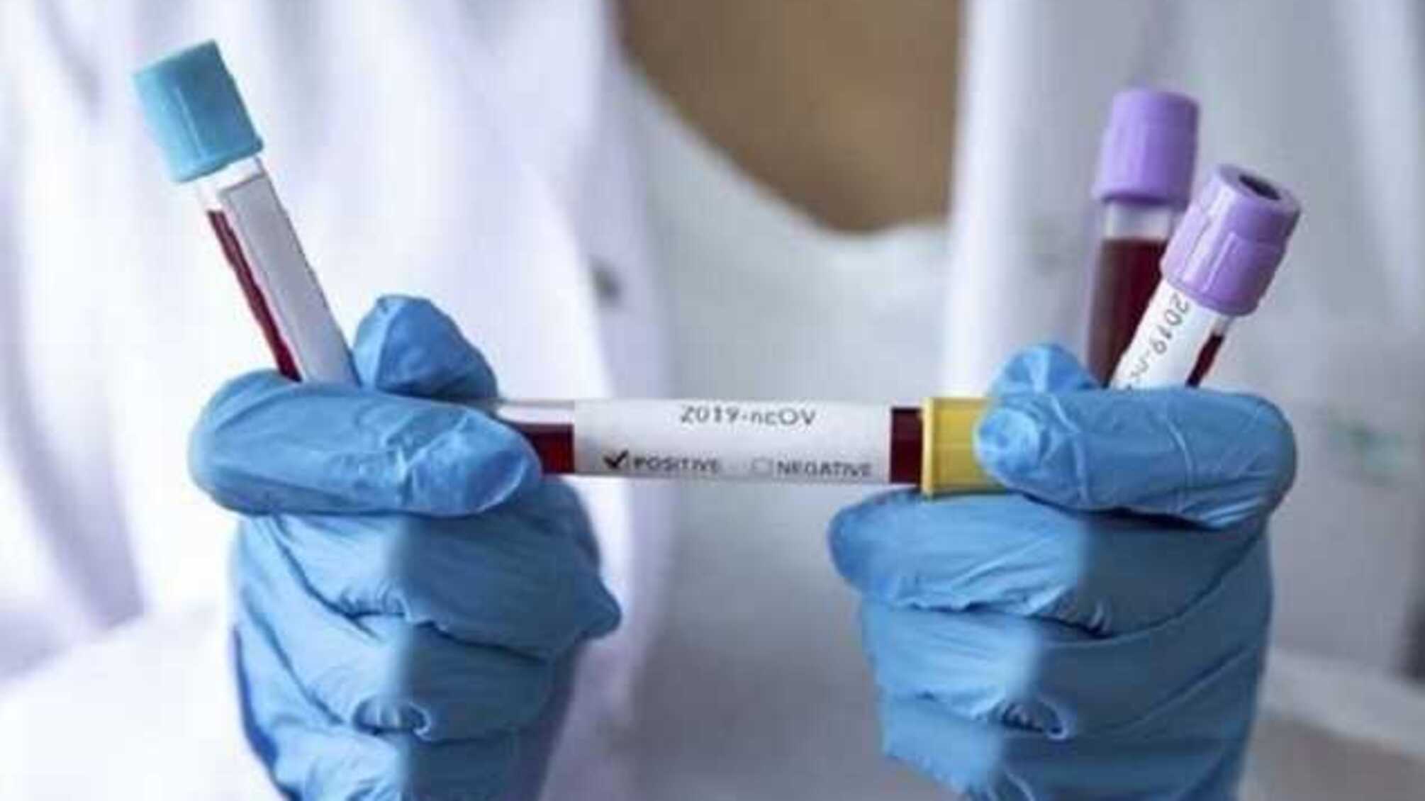 Уже больше ста: стало известно о новых случаях инфицирования коронавирусом в Украине