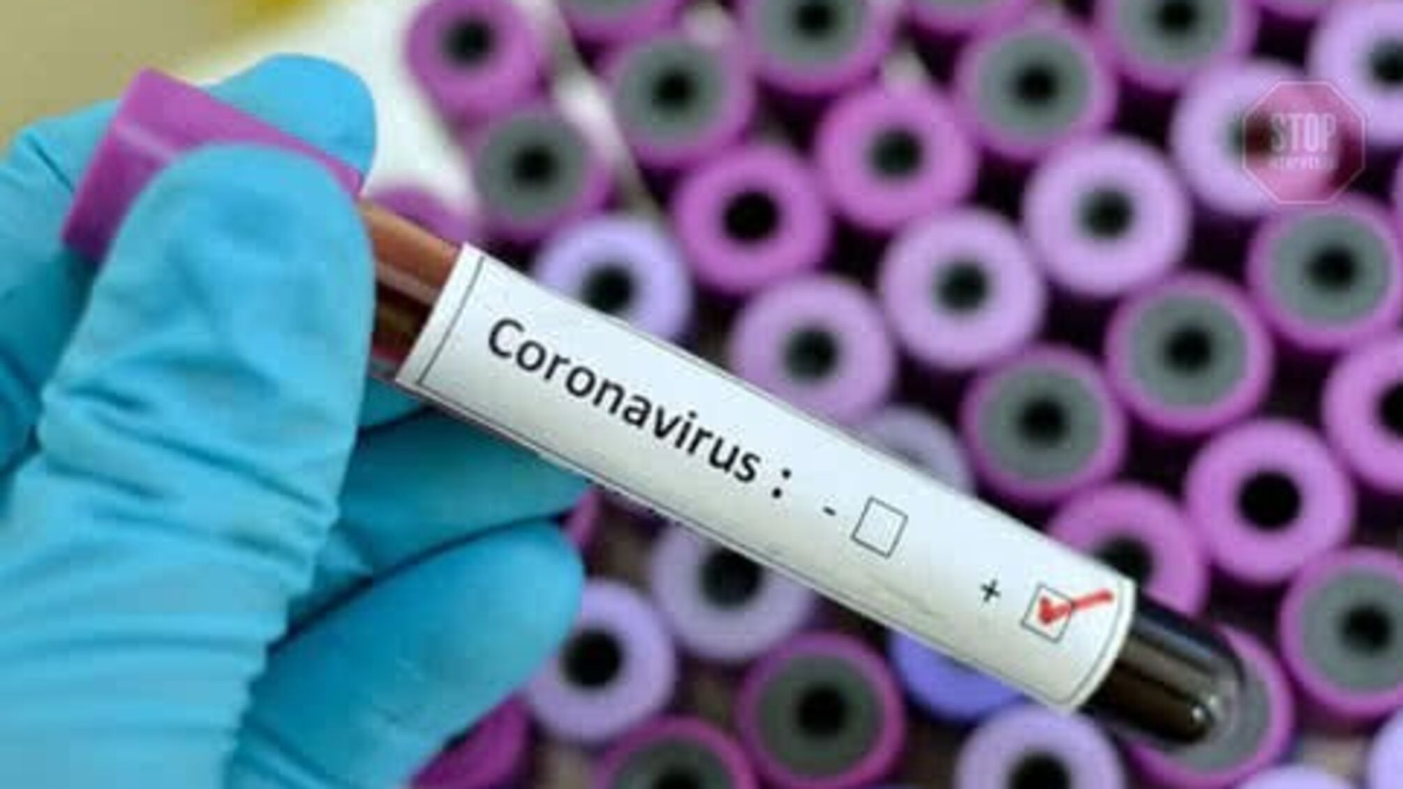 В Україні з'являться експрес-тести на коронавірус