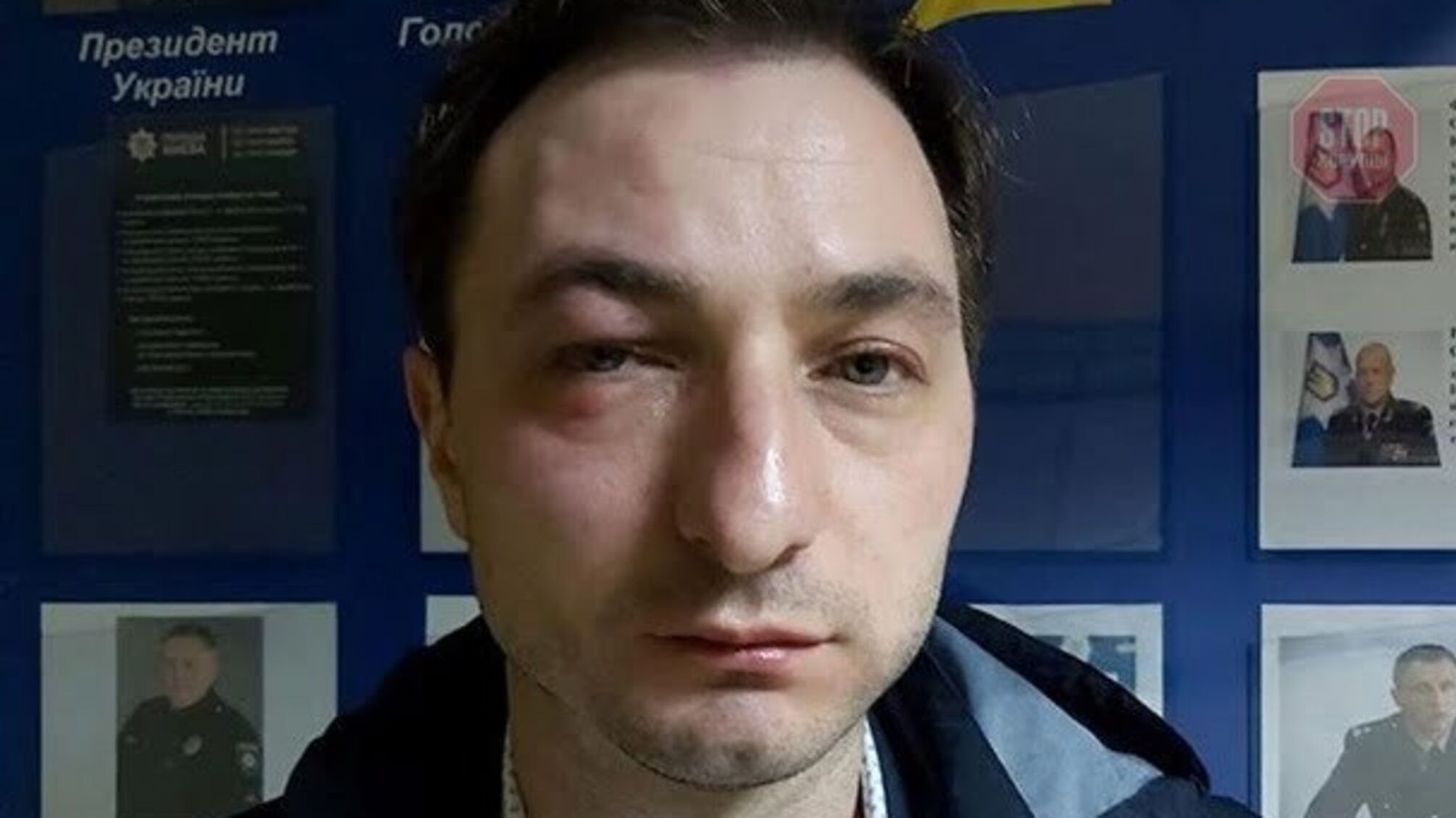 У Києві побили головного лікаря Націнституту раку