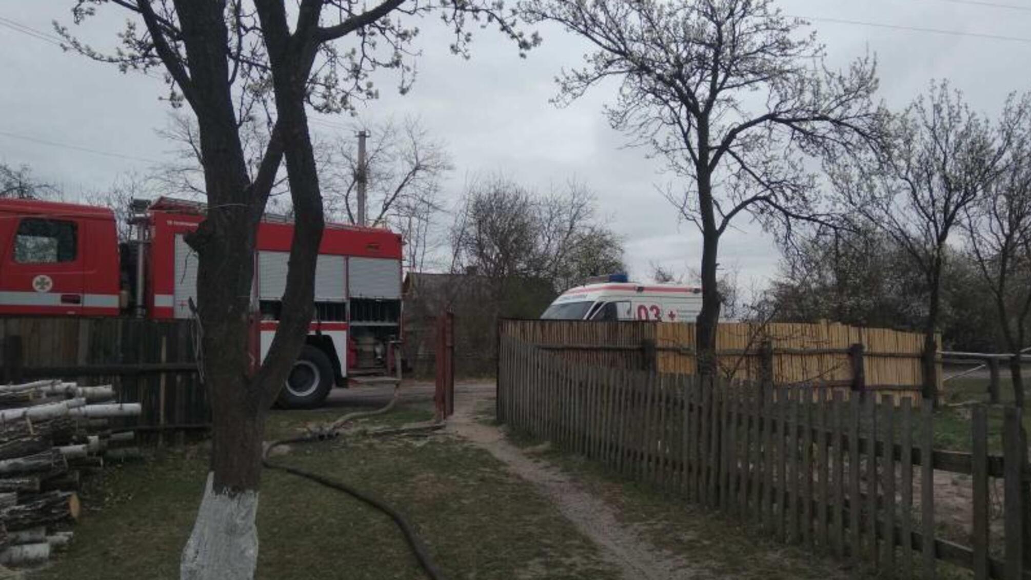 Житомирська область: на пожежі в приватній оселі отримав опіки 8-річний хлопчик
