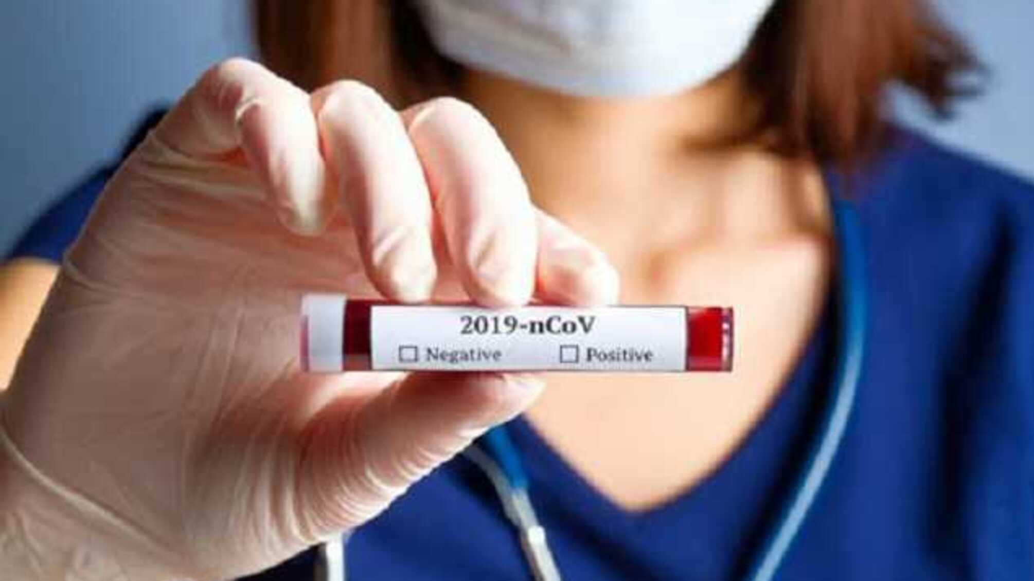 На Київщині зафіксували ще 6 випадків захворювання на коронавірус