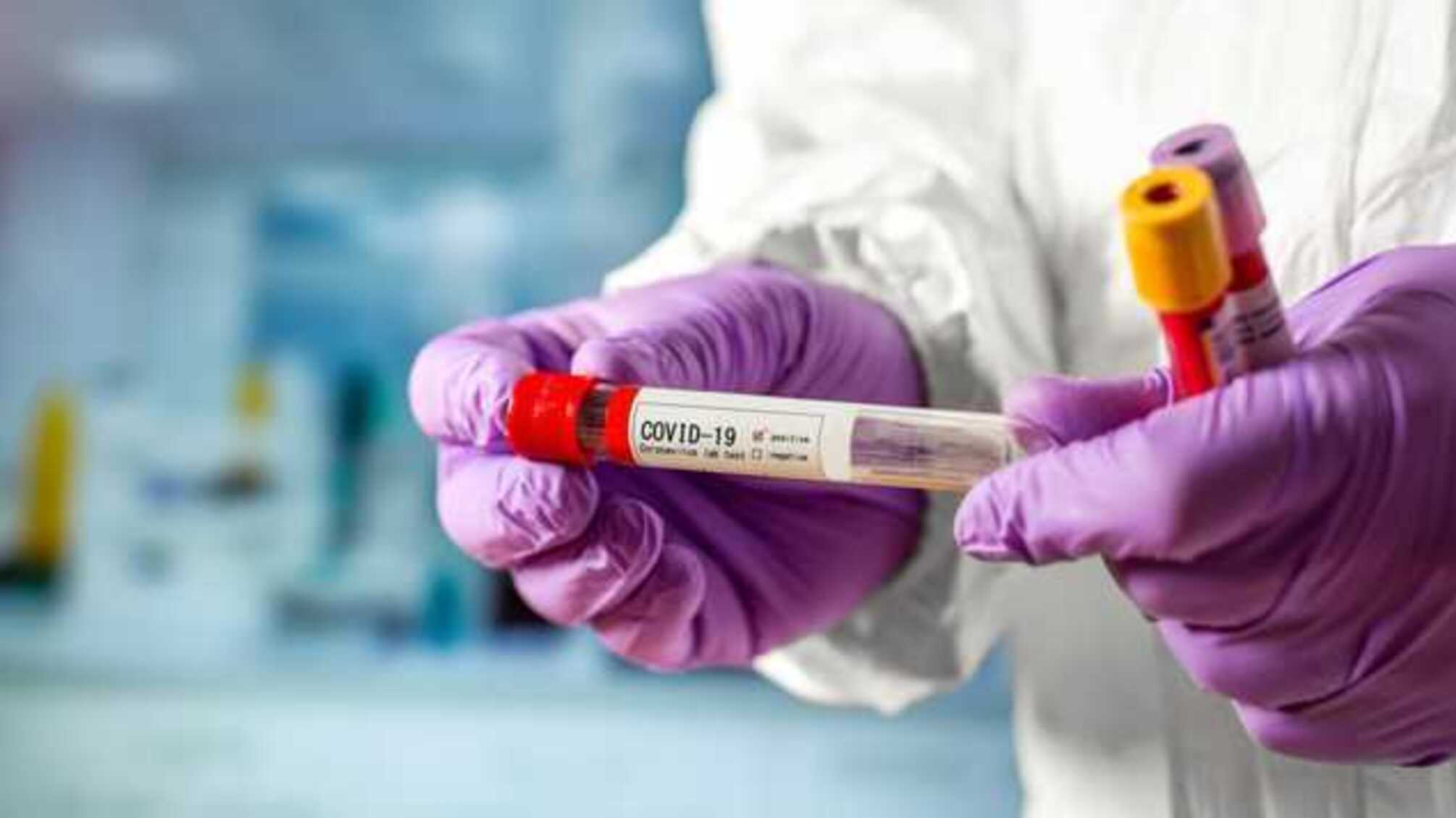 У Хотинській районній лікарні 22 медика хворіють на COVID-19