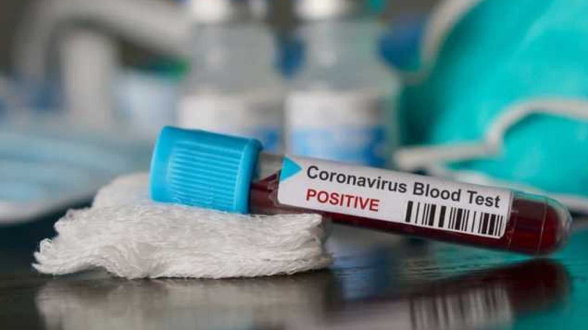 В Росії виявили понад 2,5 тис. нових випадків COVID-19