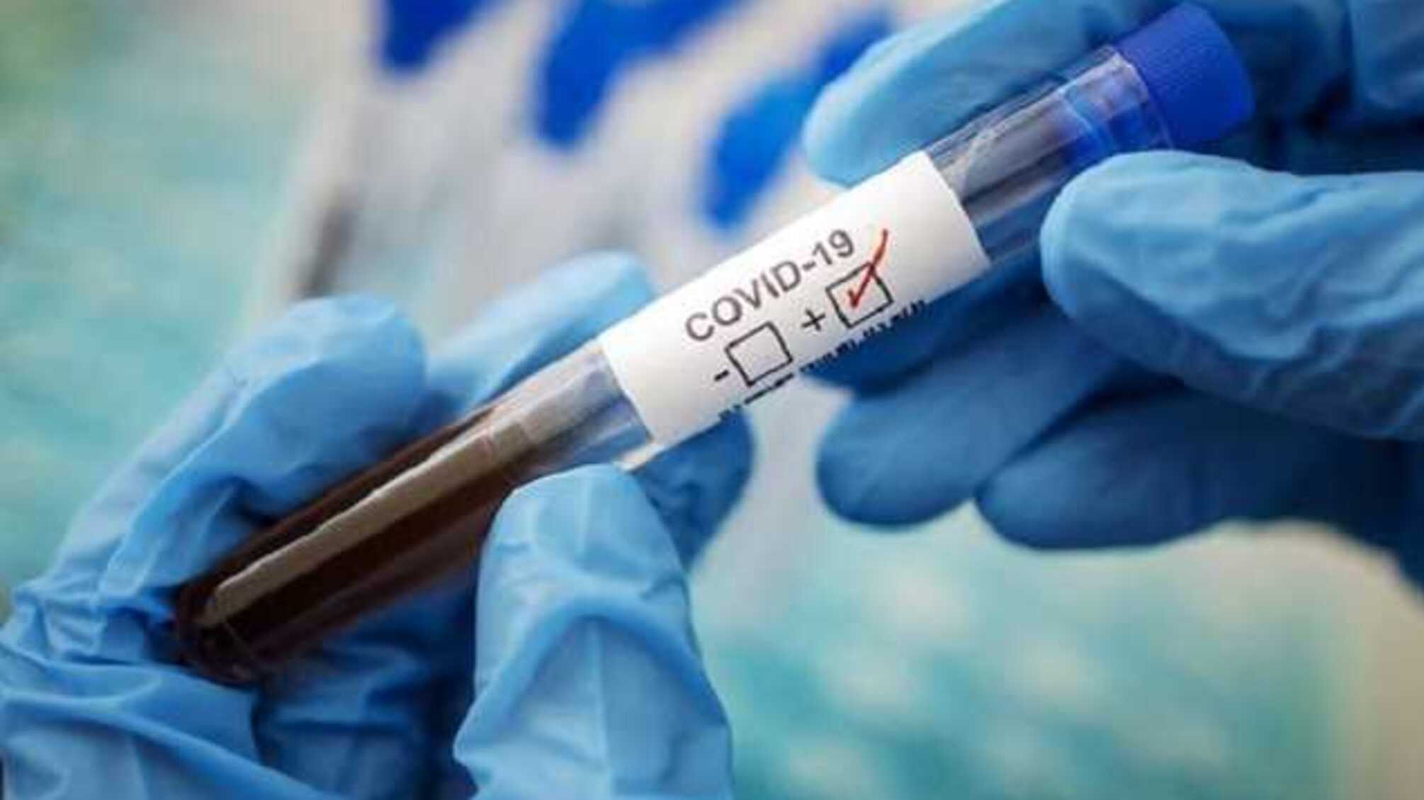 У Києві вже понад 800 хворих на коронавірус