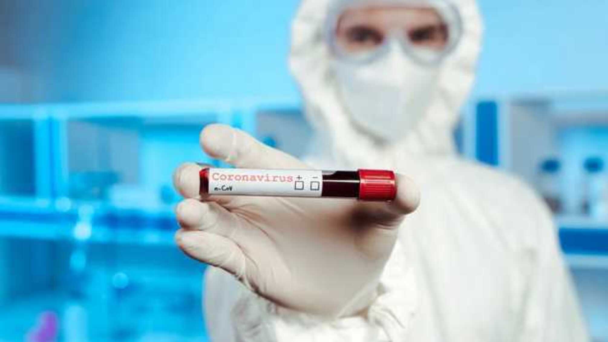 В Україні знижується число нових випадків COVID-19