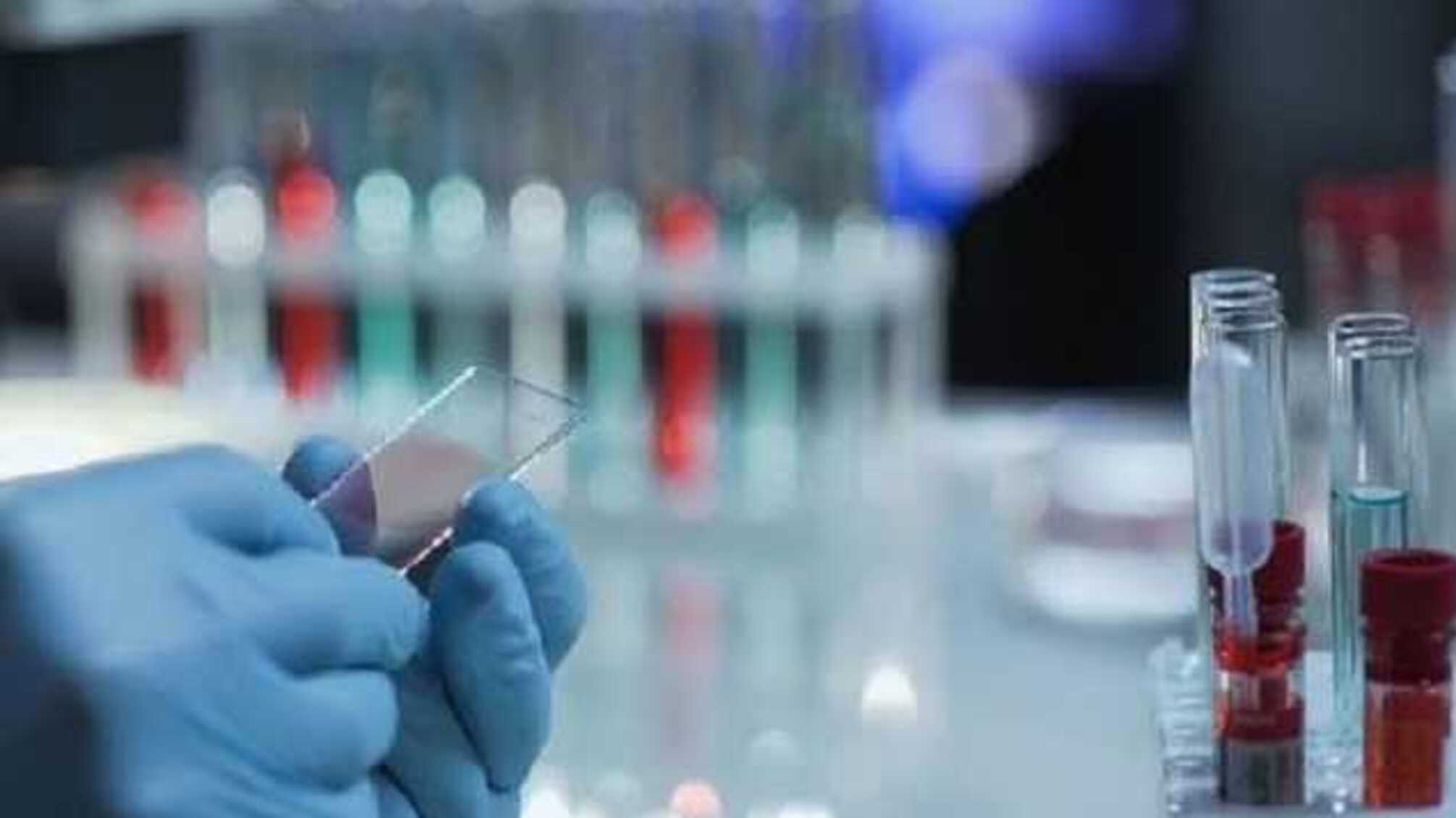 В Херсонской области увеличилось количество заболевших COVID-19