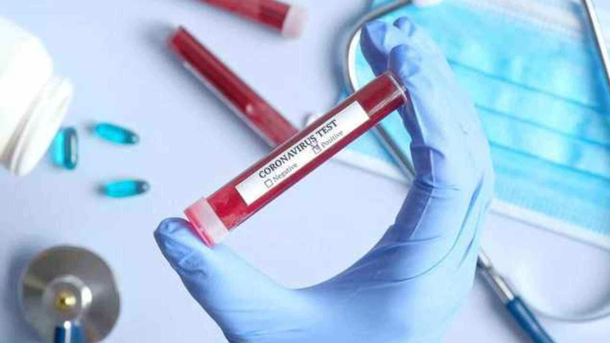 В Україні за добу зафіксовано майже півтисячі нових хворих на COVID-19