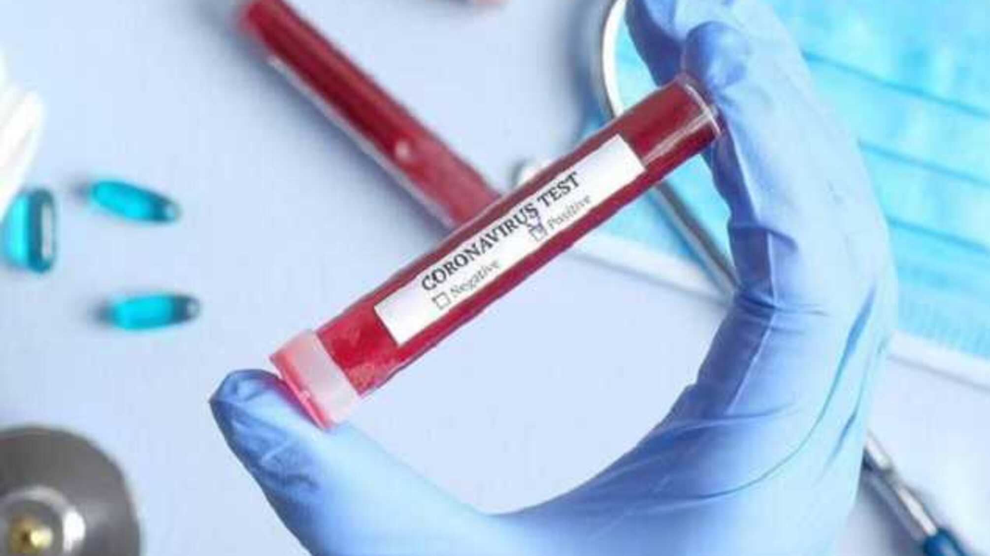 В оккупированному Крыму зарегистрировано 70 случаев COVID-19