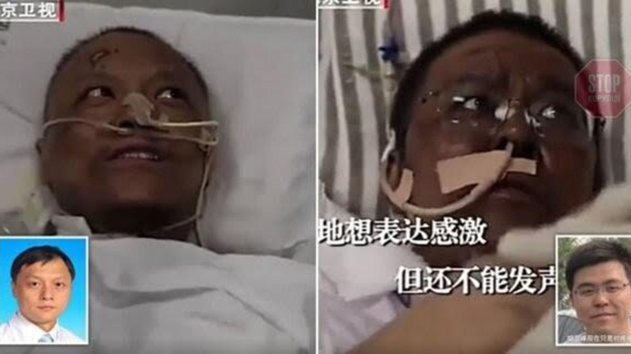 У двох лікарів з Китаю, які захворіли на COVID-19, з'явився неочікуванний симптом (фото)