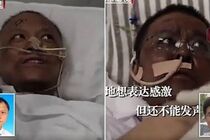 У двох лікарів з Китаю, які захворіли на COVID-19, з'явився неочікуванний симптом (фото)