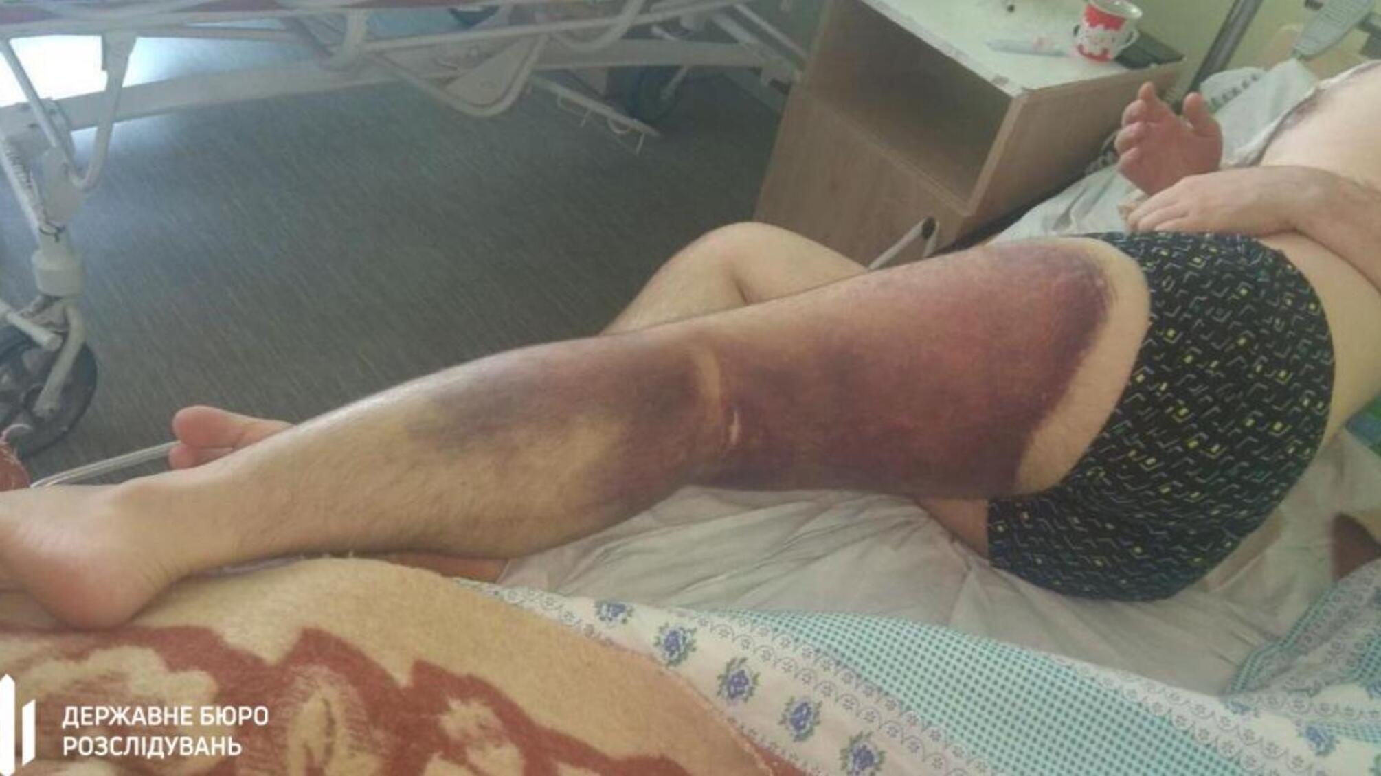 ДБР повідомило про підозру трьом поліцейським та курсанту академії у побитті оператора майнінг-ферми