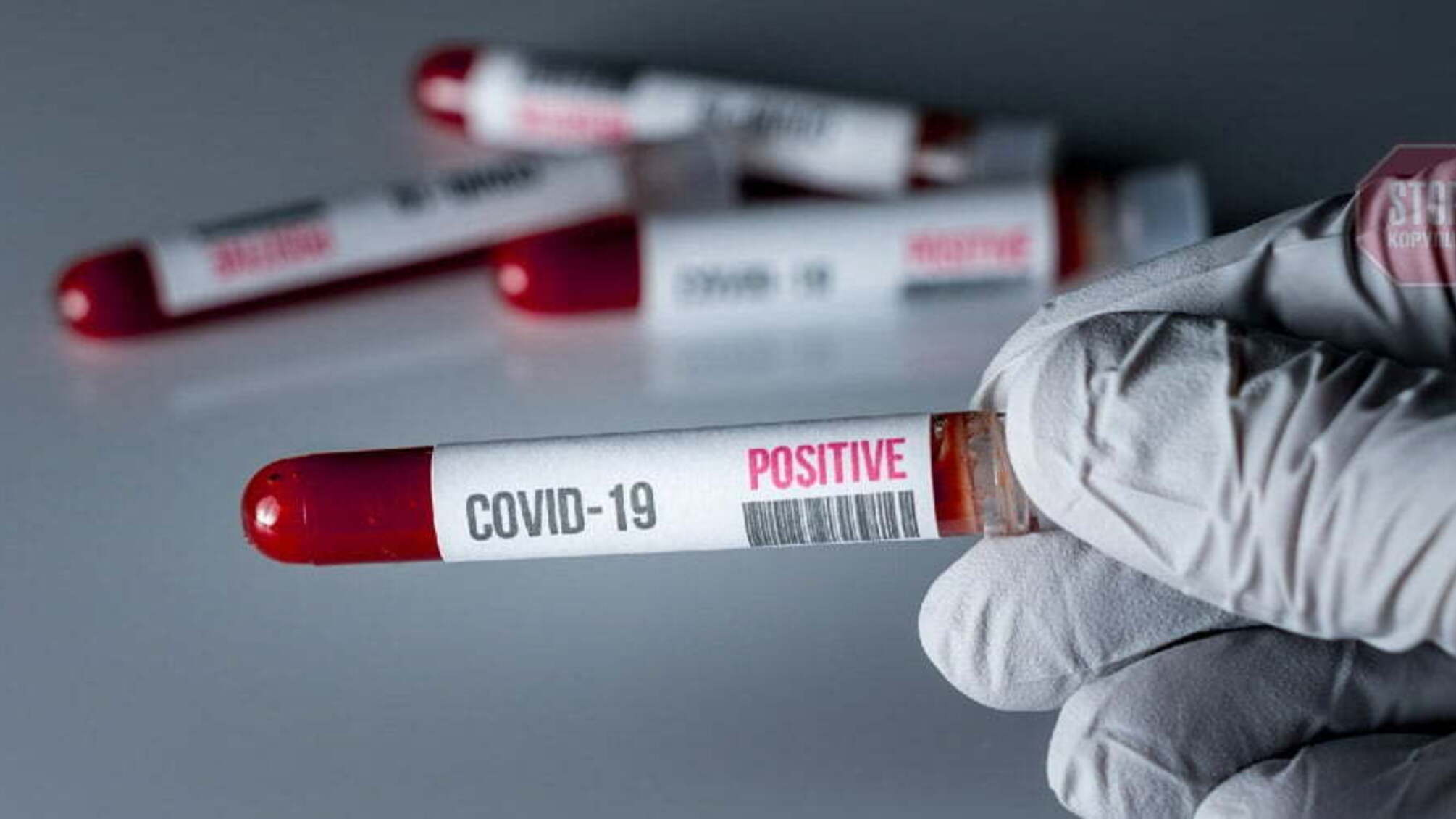 В Україні зросла кількість нових випадків COVID-19