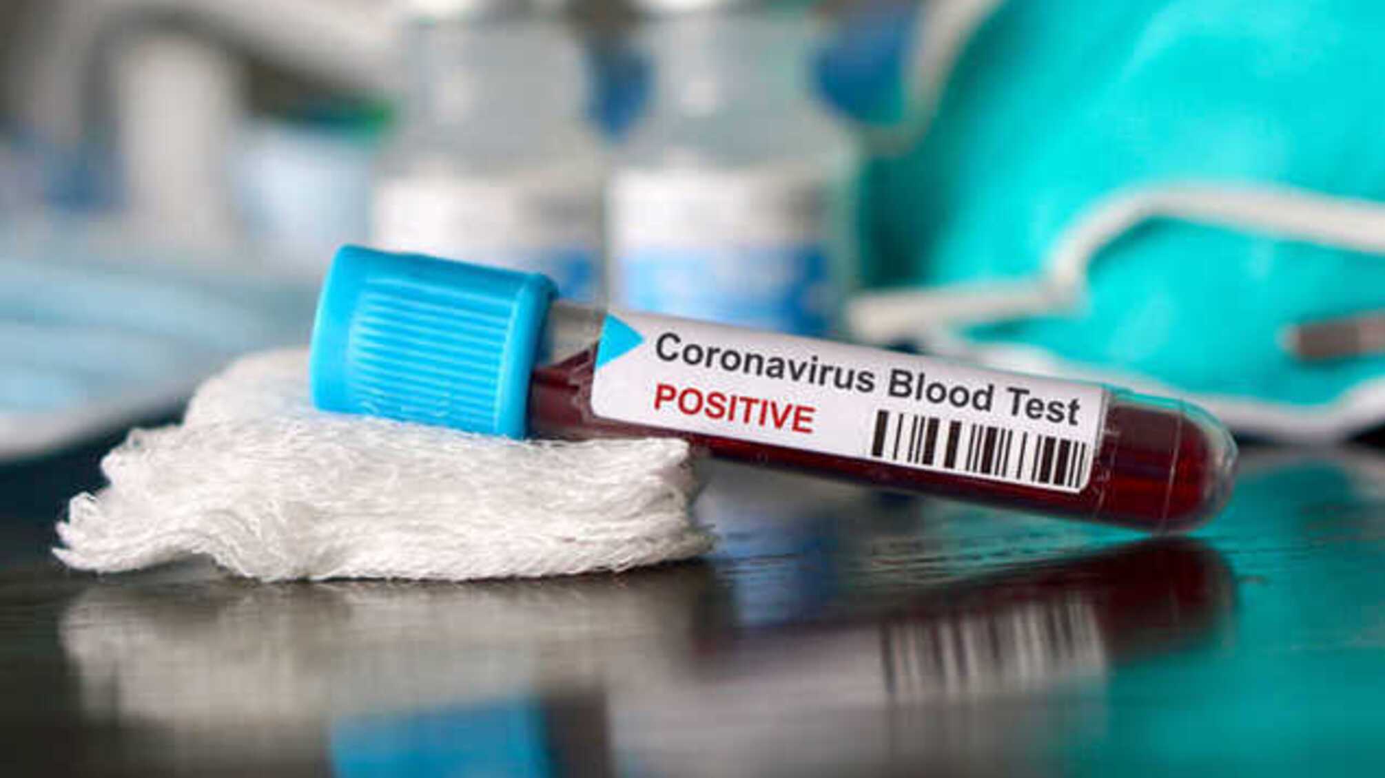 Плюс 402 за сутки: в Украине заразились коронавирусом 16 425 человек