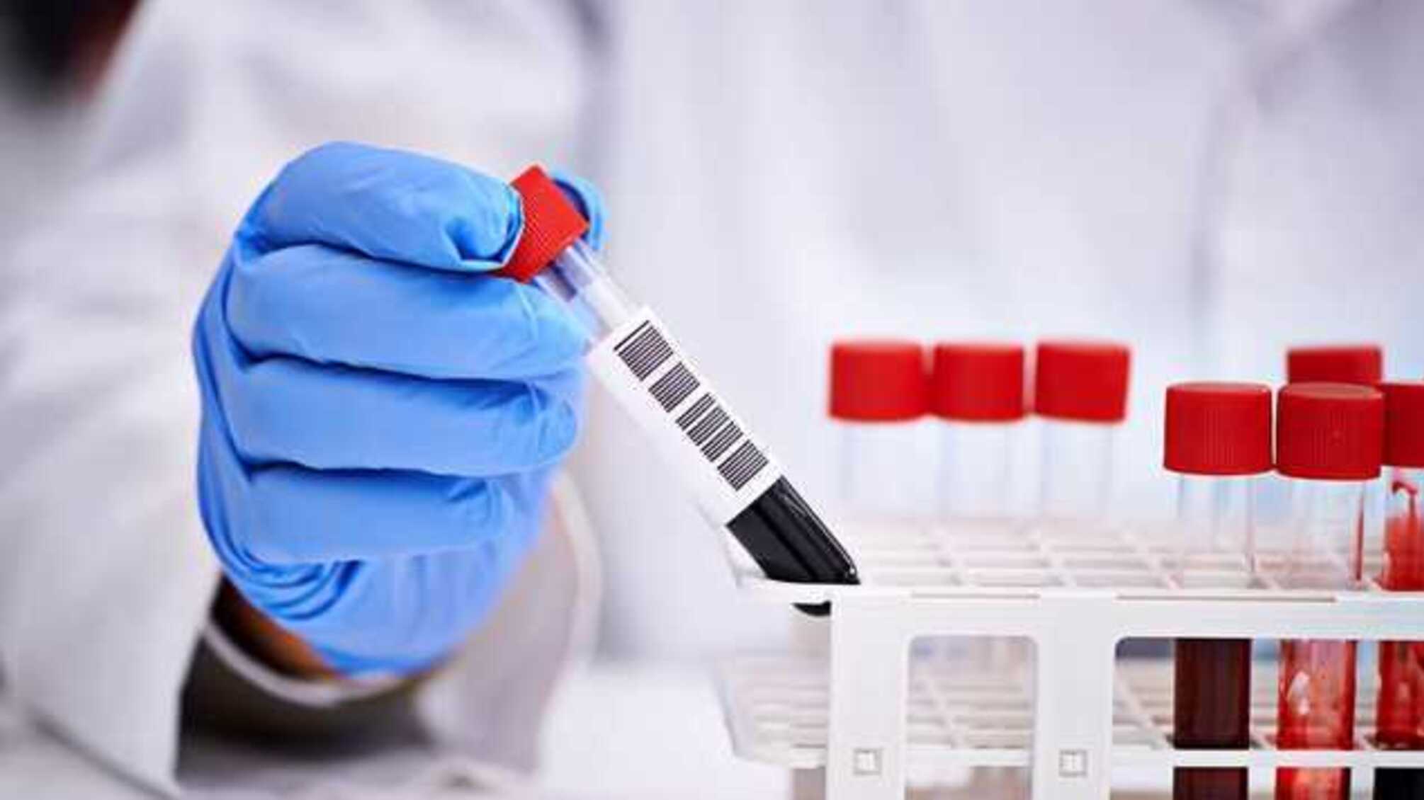 На Вінниччині від коронавірусу помер священик московської церкви