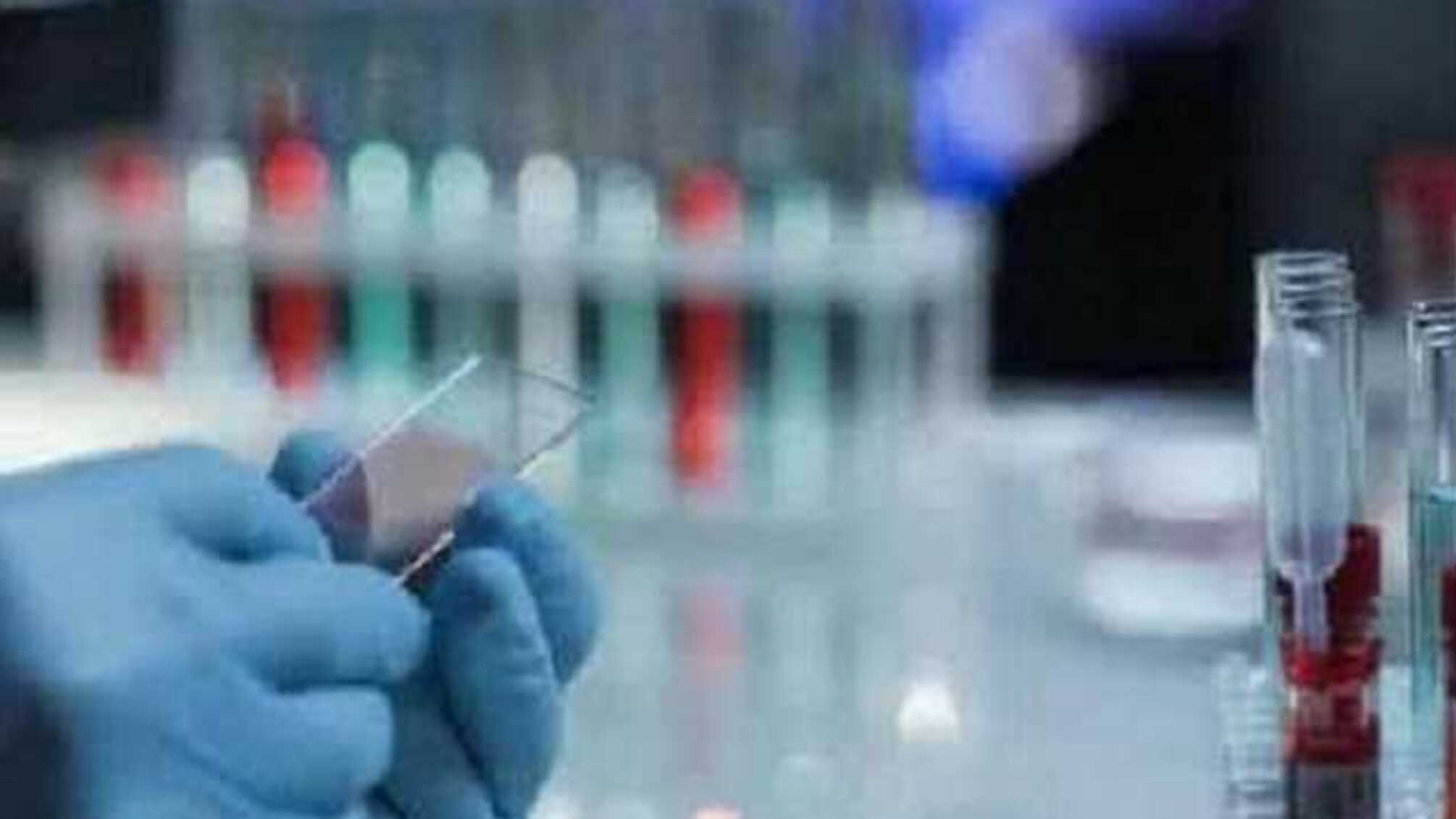 На Львівщині COVID-19 діагностували ще у 50 осіб