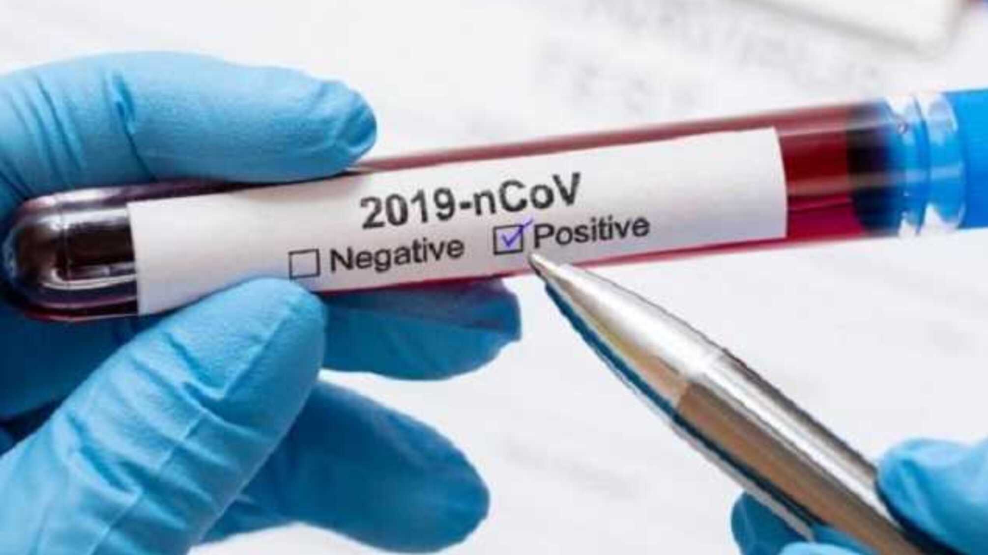 Количество больных COVID-19 в Украине перевалило за 17 тысяч человек