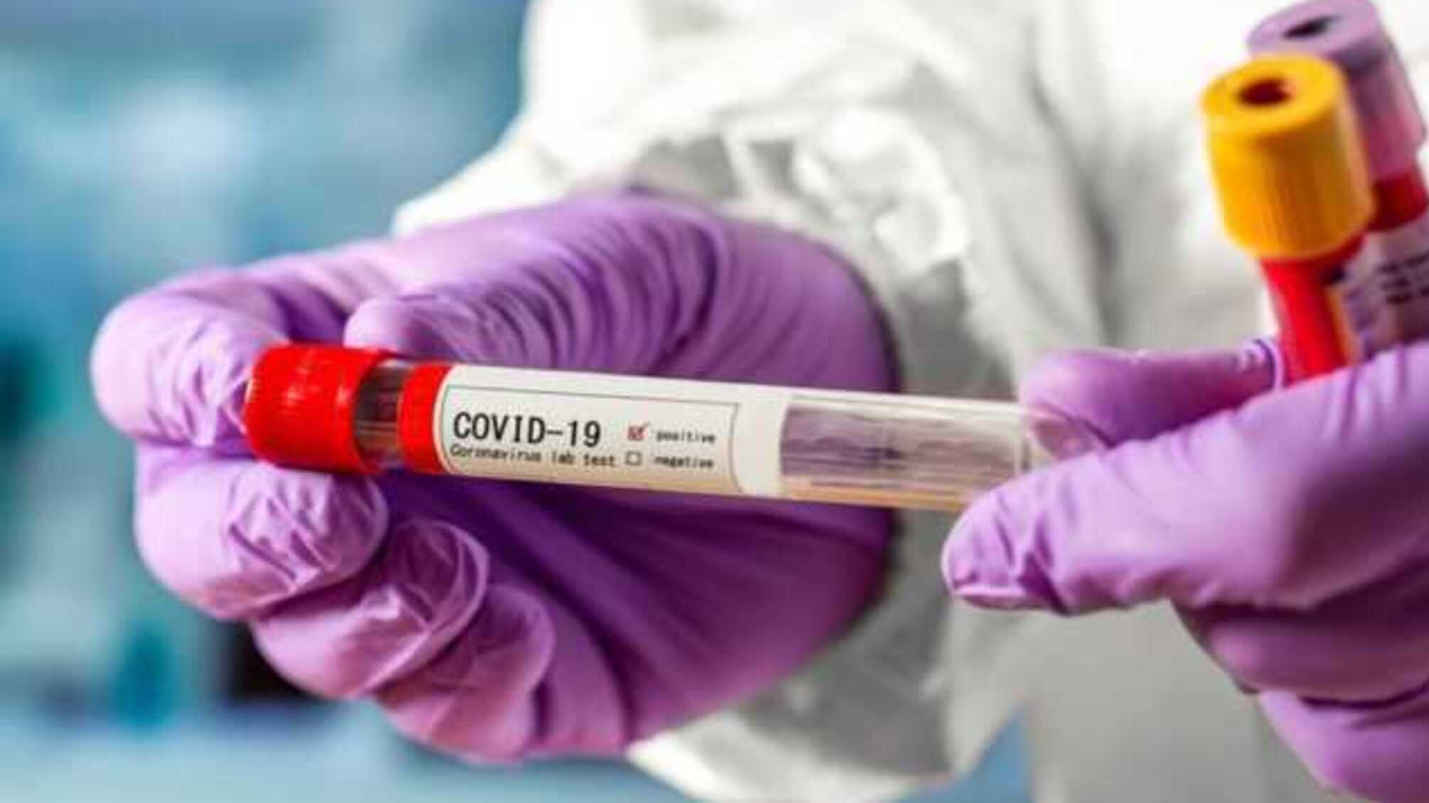 Росія на другому місці у світі за кількістю інфікованих COVID-19