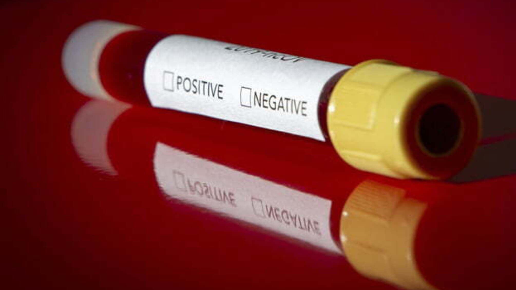 Кількість заражених коронавірусом у Нідерландах перевищила 43,8 тисячі