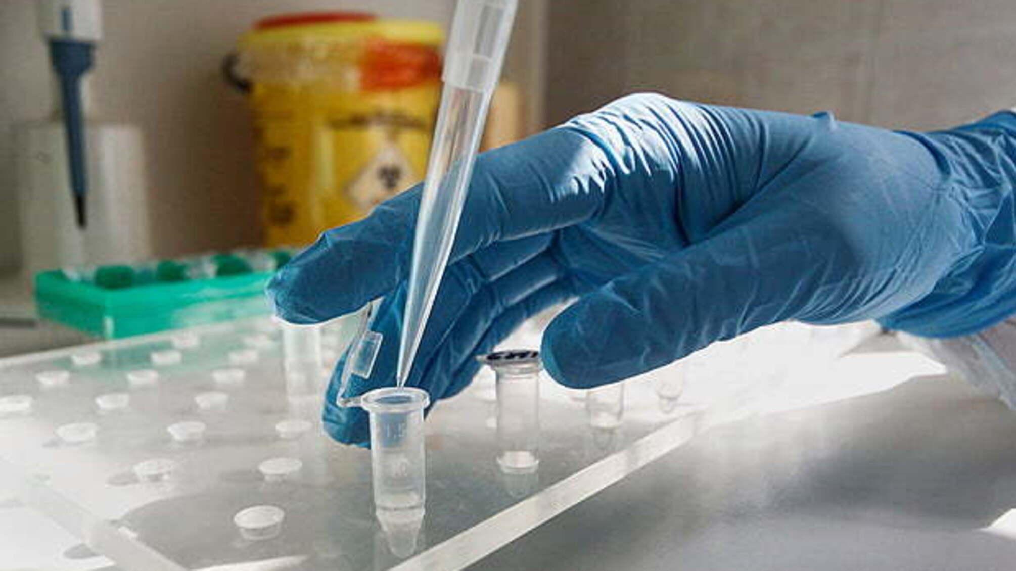 У Краматорську через інфіковану на COVID-19 пацієнтку протестують усю дитячу лікарню