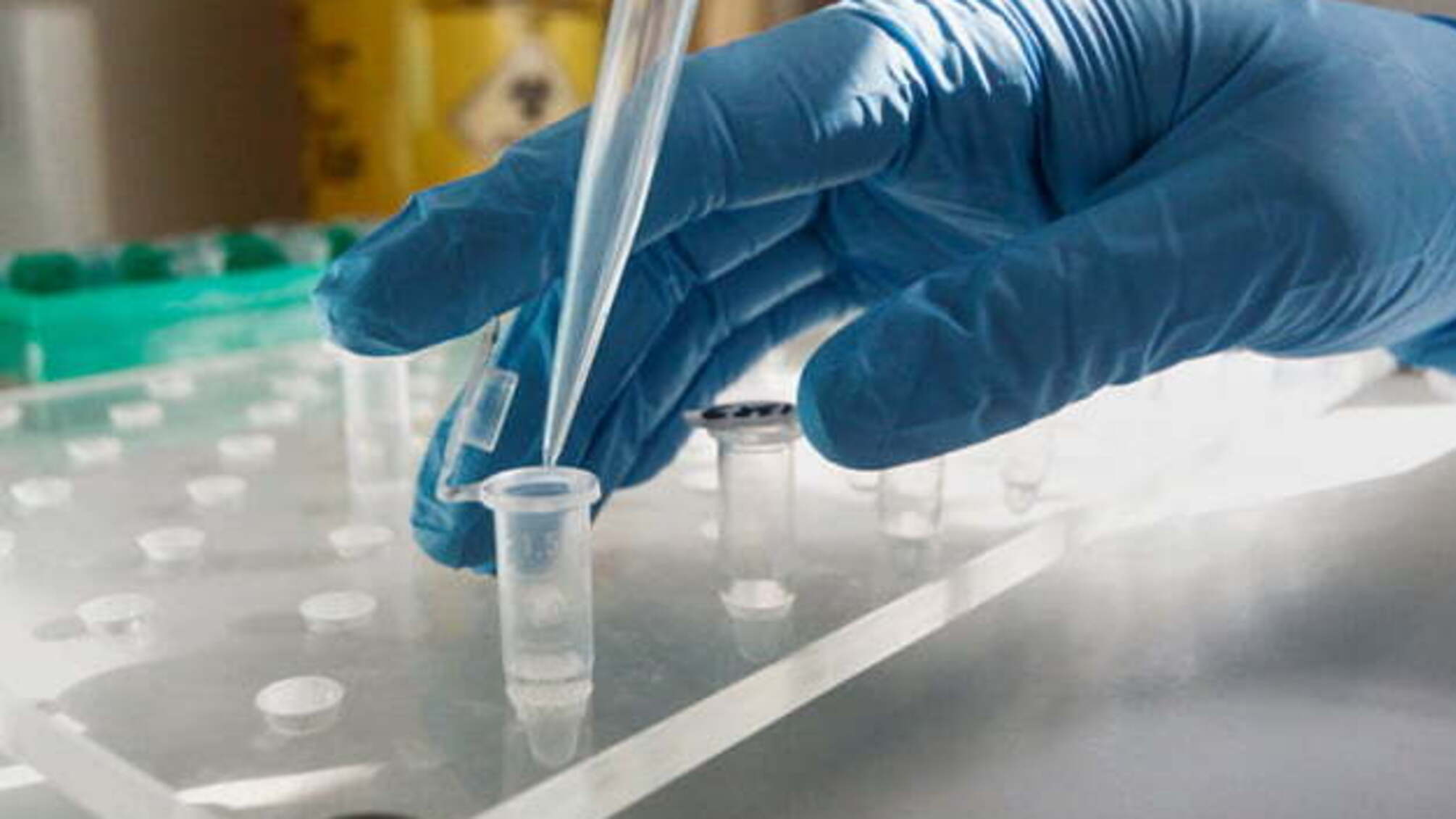 На Рівненщині за день одужало понад 60 людей хворих на COVID-19