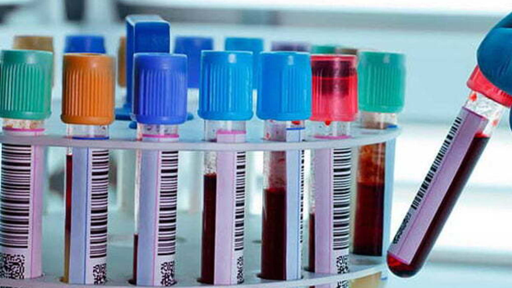 У США кількість жертв коронавірусу перевищила сто тисяч осіб