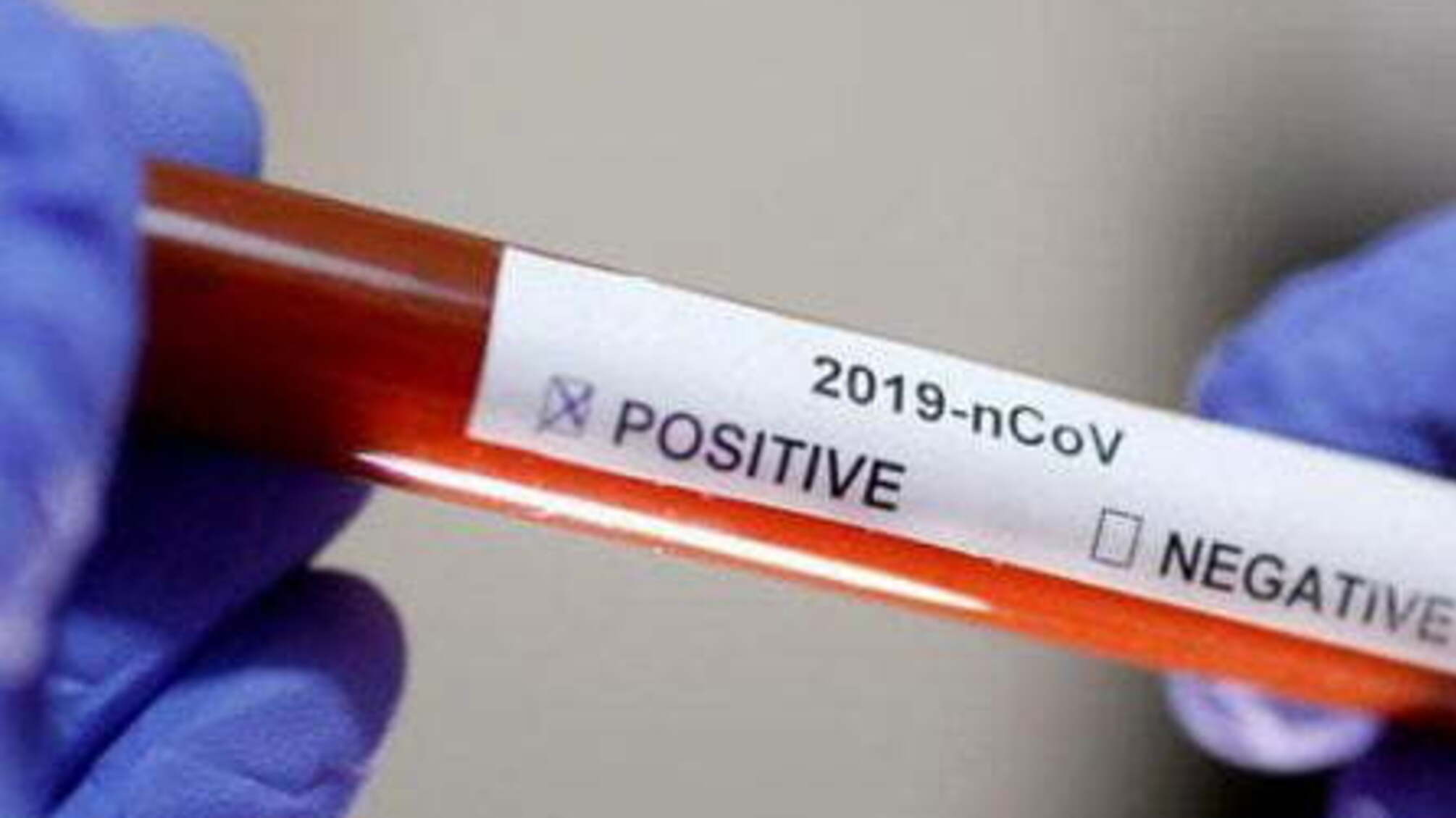 На Закарпатті у школі-інтернаті виявили 17 хворих на COVID-19