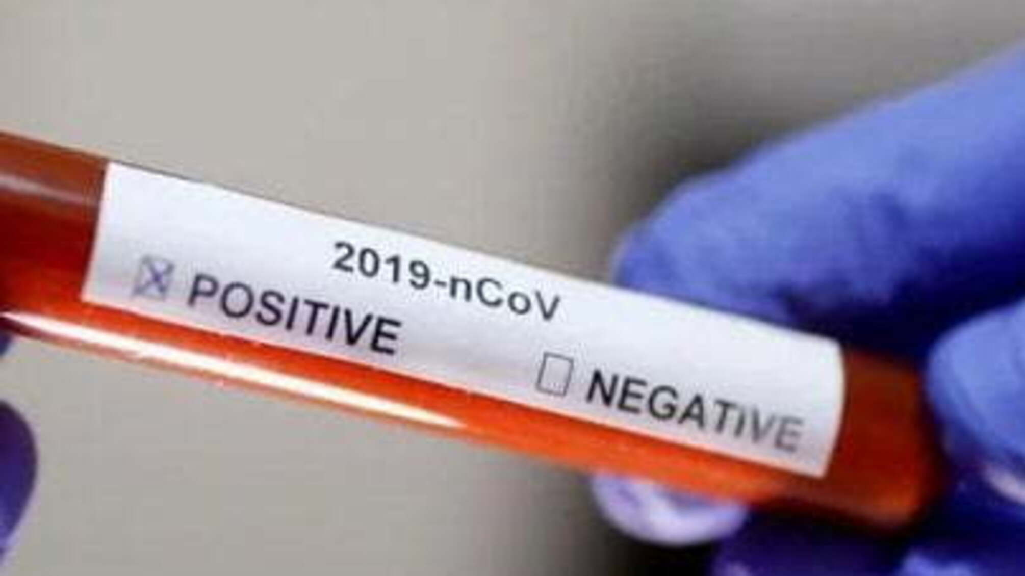 На Одещині за добу виявили нові випадки COVID-19