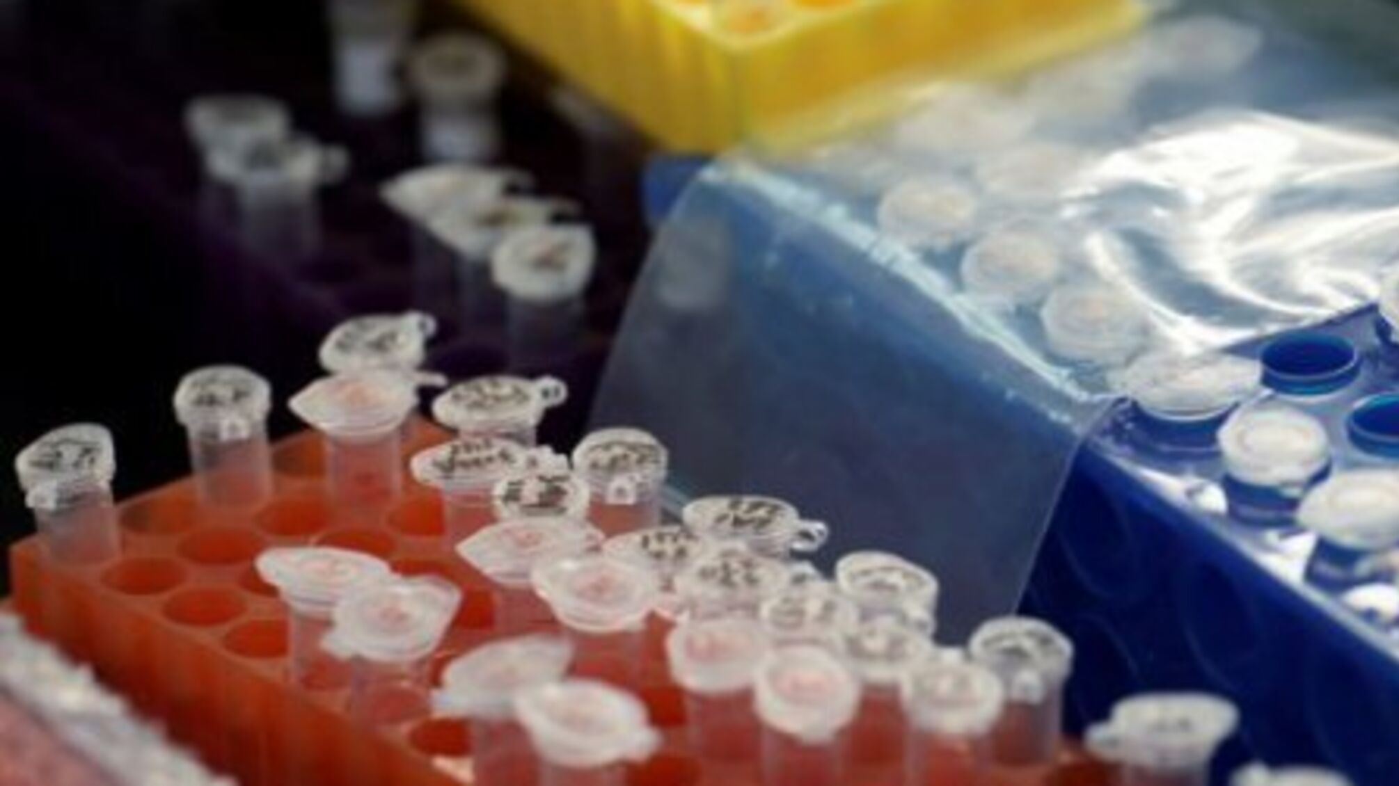 Столичних медиків почали тестувати на антитіла до Covid-19