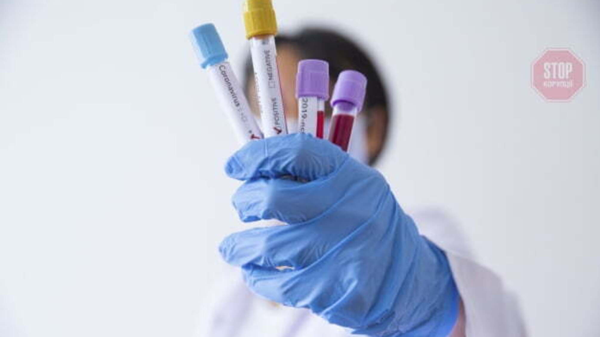 Півтора мільйона для державного розробника тестів на COVID-19 «застрягли» у Кабміні