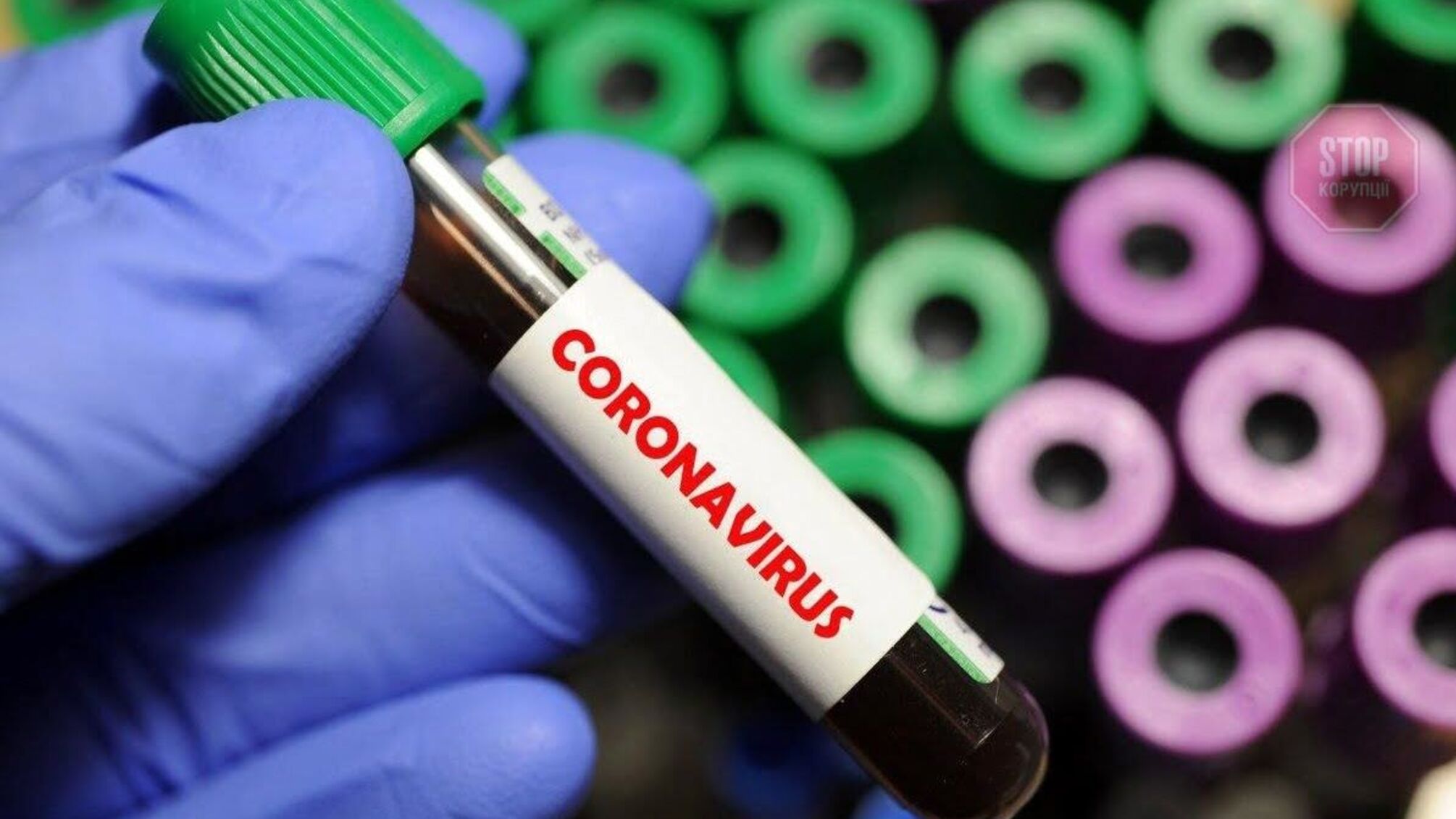 На Буковині зафіксували майже 40 нових випадків коронавірусу