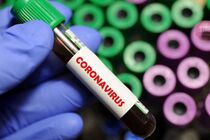 На Буковині зафіксували майже 40 нових випадків коронавірусу