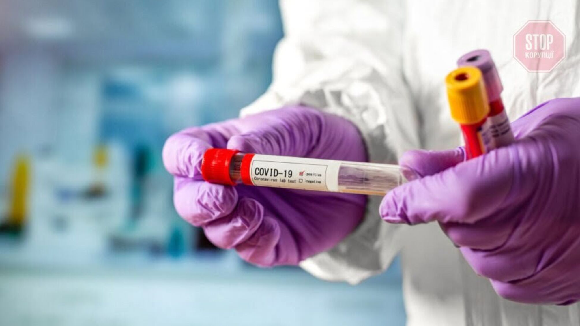 На Рівненщині за час епідемії коронавірусу звільнилися понад 300 медиків