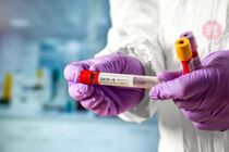 На Рівненщині за час епідемії коронавірусу звільнилися понад 300 медиків