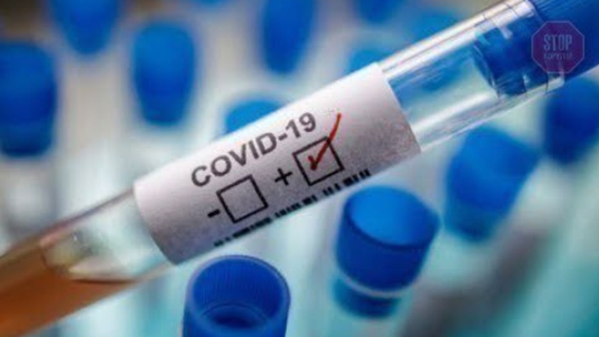 В Україні за добу понад 400 нових випадків COVID-19