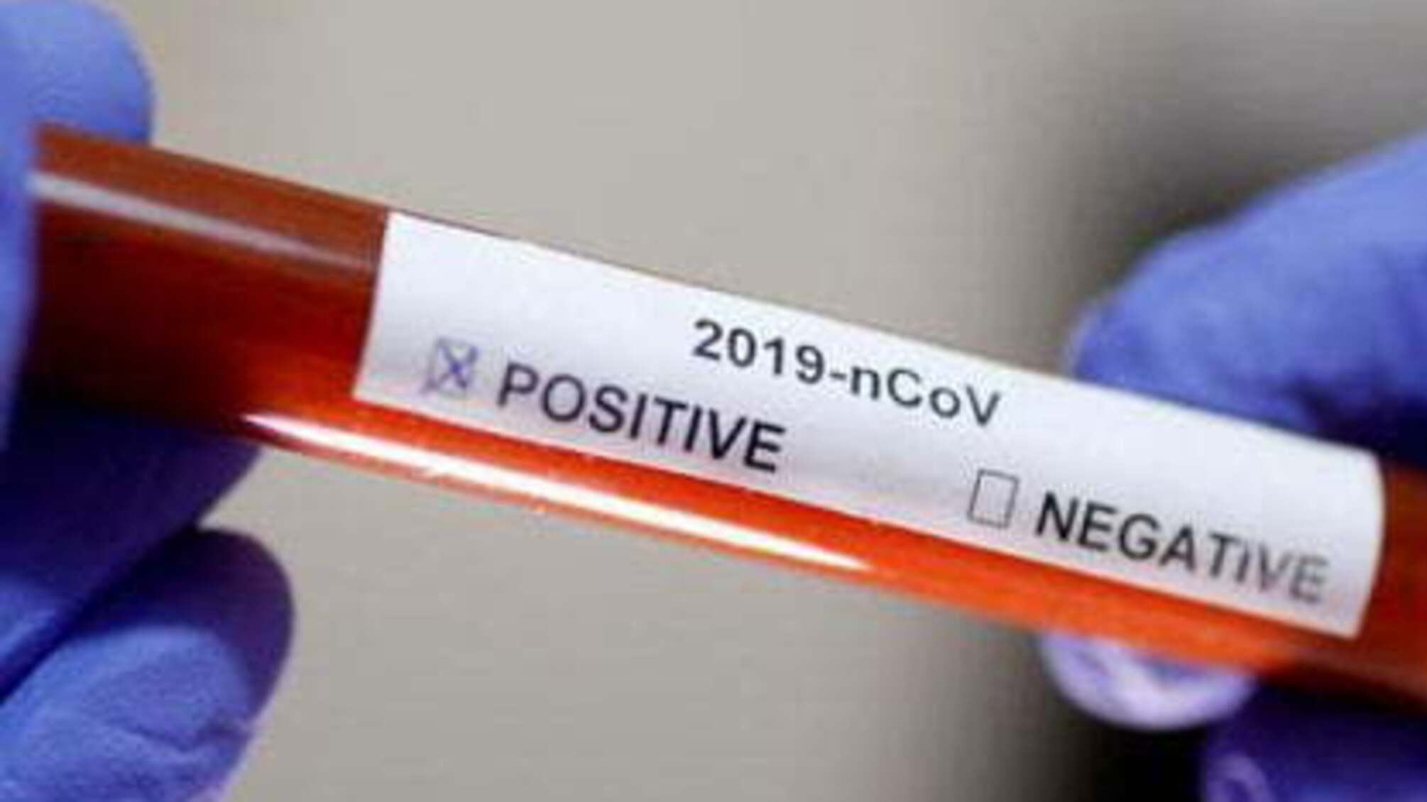 У співробітника РНБО діагностували Covid-19