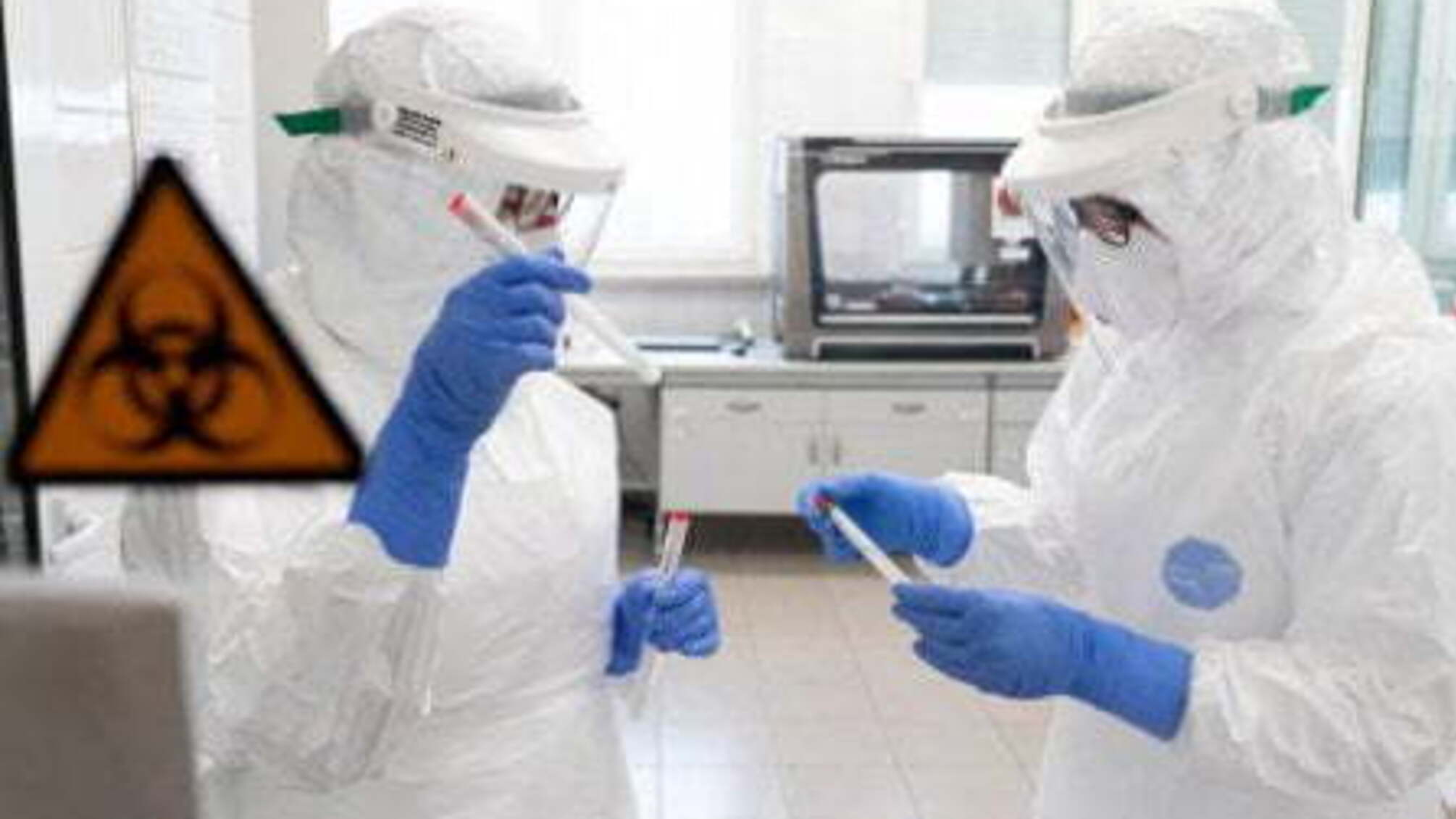 Лікарі дослідили зв'язок Covid-19 з важкою патологією у вагітних